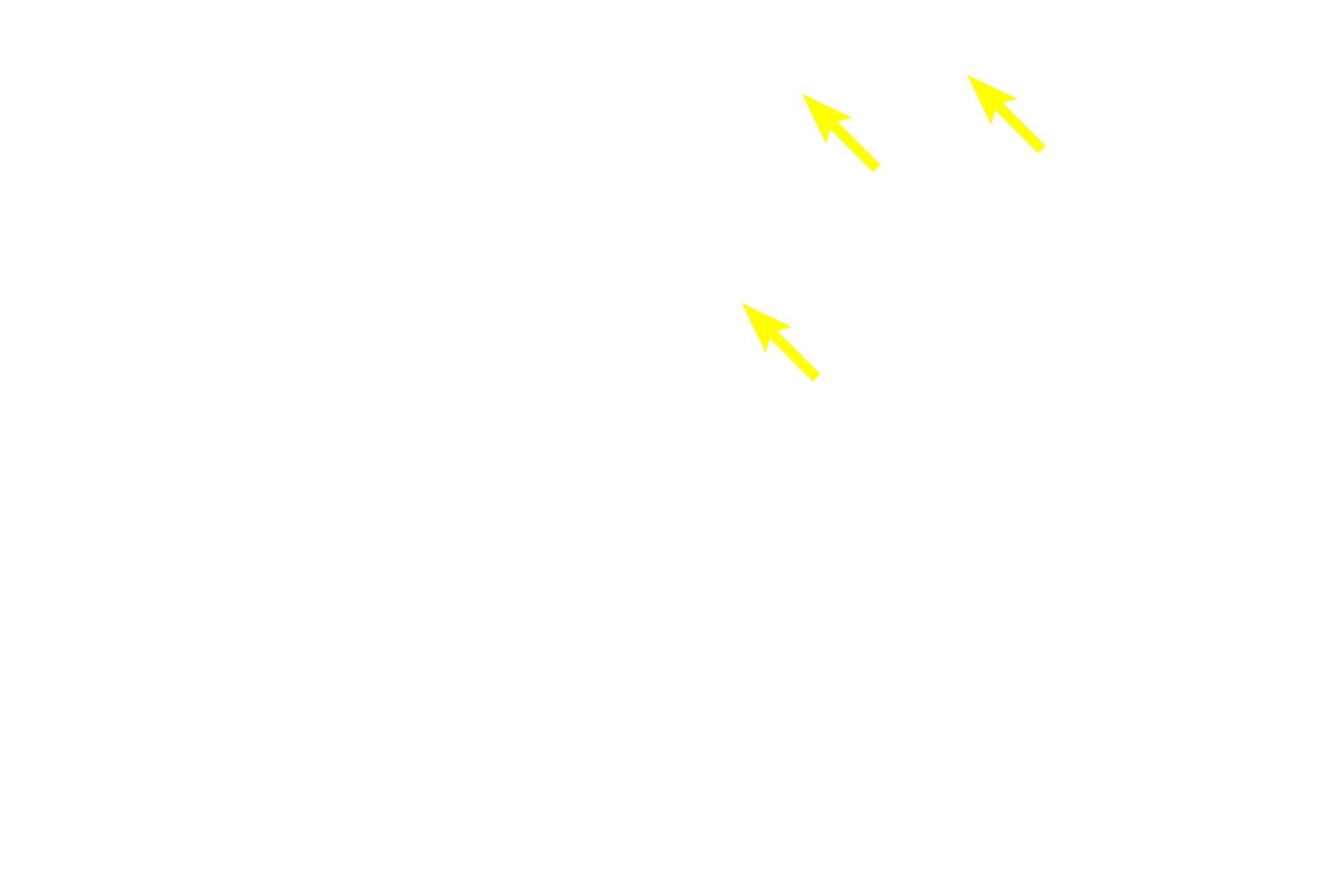 Peyer’s patch > <p>The lamina propria in the distal portions of the small intestine contains accumulations of MALT called Peyer’s patches, as seen in this section of the ileum.  </p>
