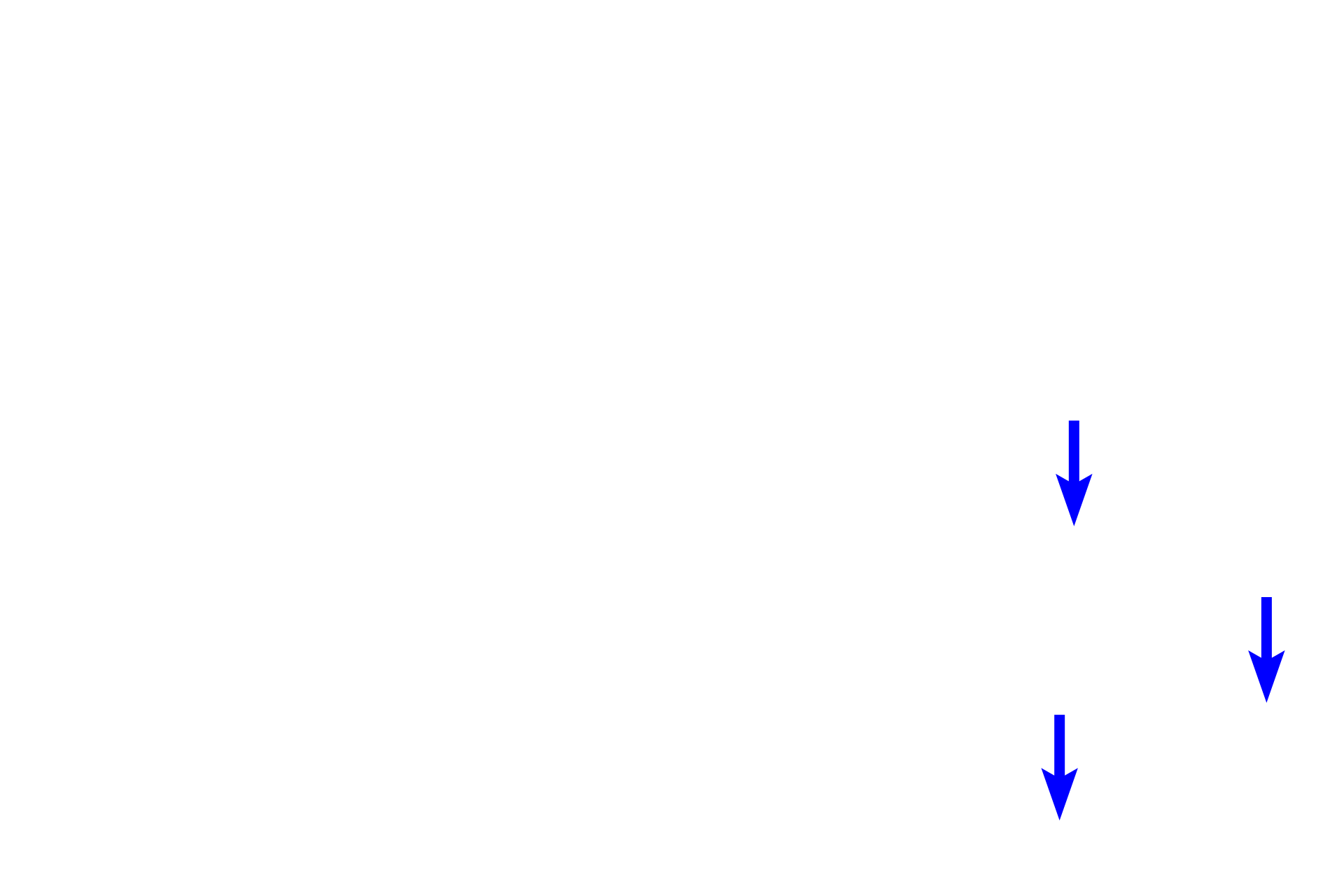  - Diffuse lymphoid tissue <p>The appendix, an appendage of the large intestine, is heavily infiltrated with MALT forming large numbers of lymphoid nodules.</p>
