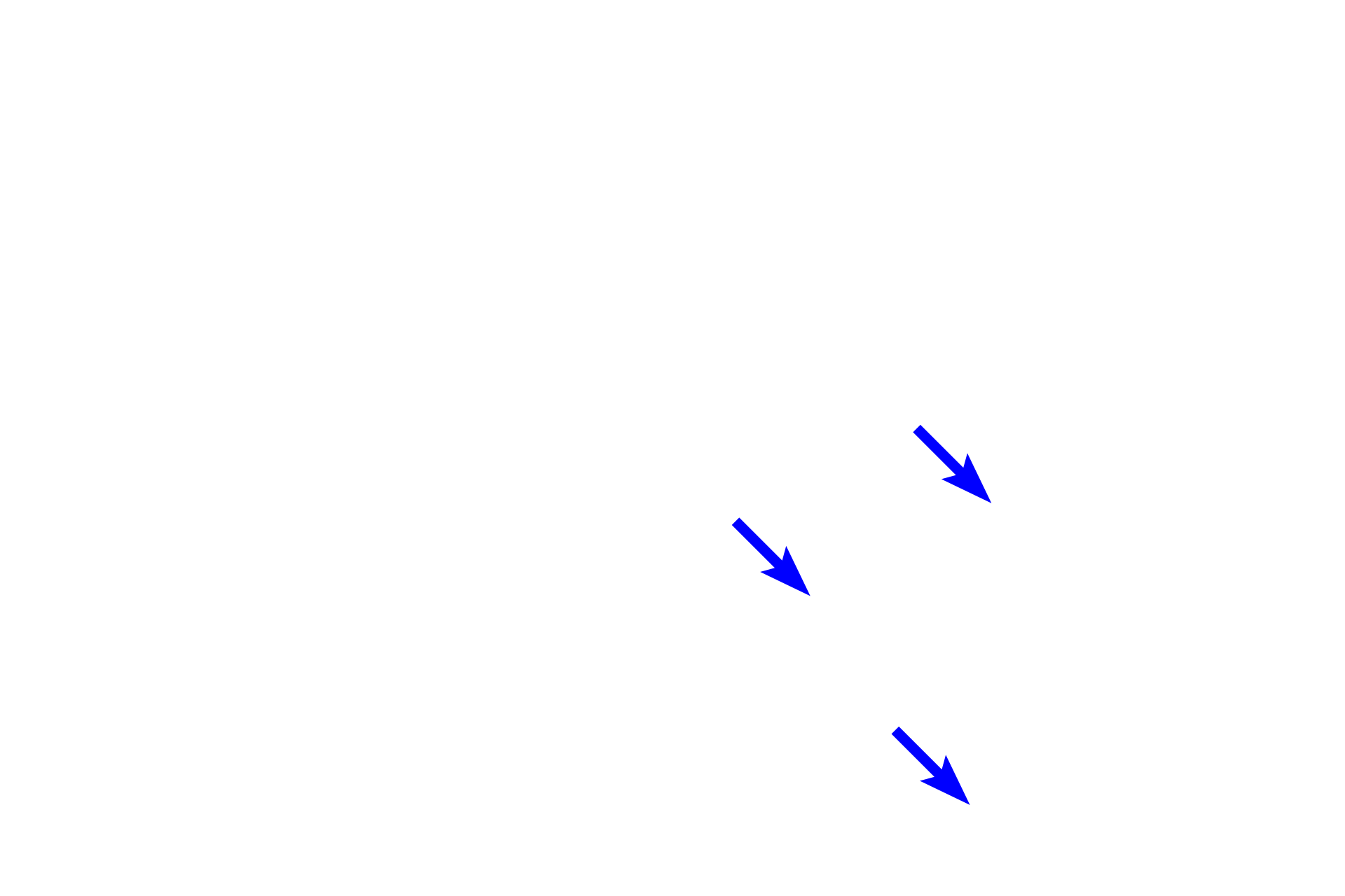  - Secondary nodules  <p>The appendix, an appendage of the large intestine, is heavily infiltrated with MALT forming large numbers of lymphoid nodules.</p>
