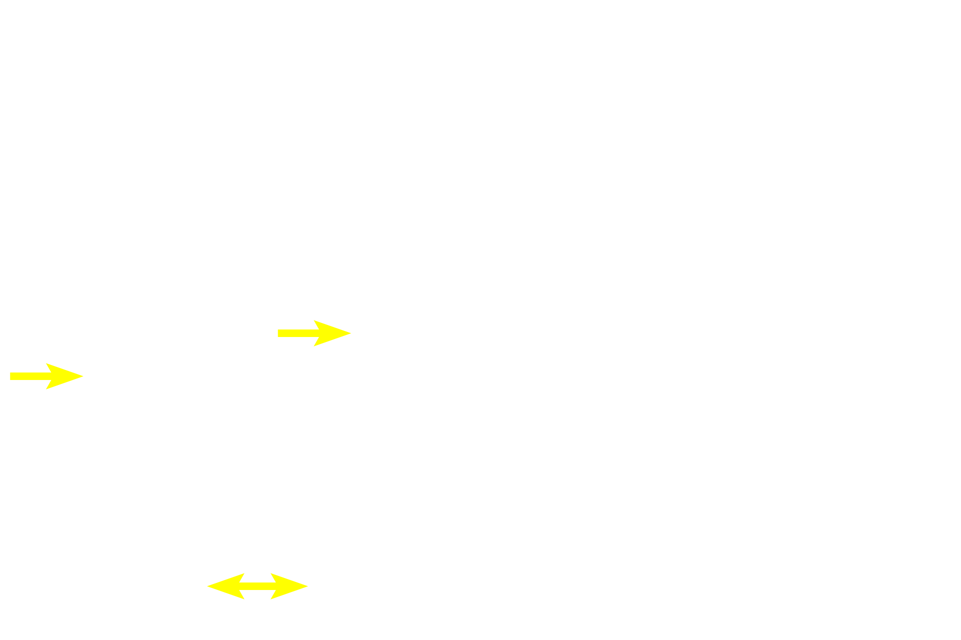  - Connective tissue <p>Tonsilar tissue is surfaced by the moist, stratified squamous epithelium of the oral and pharyngeal mucosae.  Beneath the tonsil is a partial capsule consisting of submucosal connective tissue.</p>
