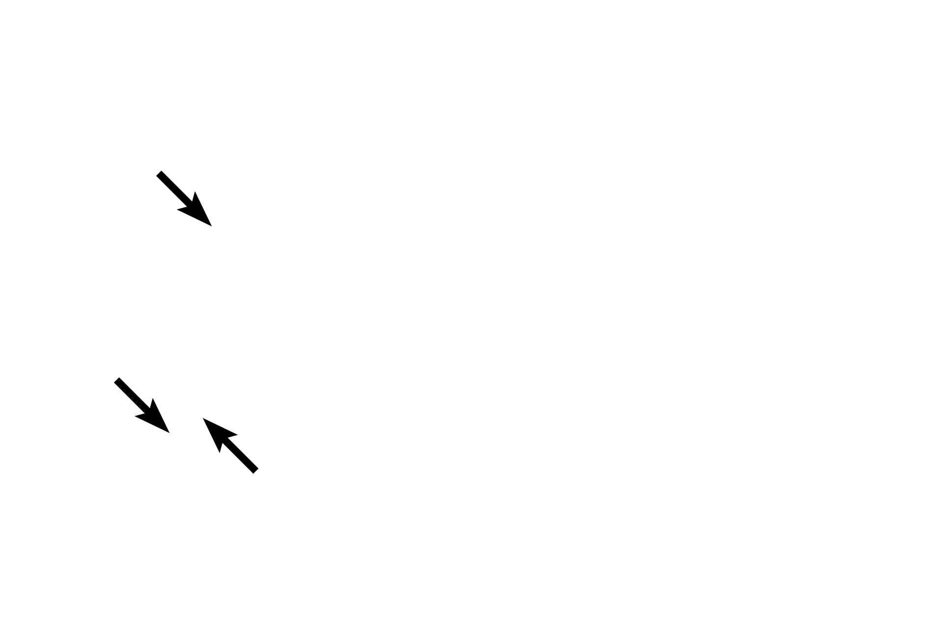 Lymph vessels <p>Lymph nodes are small, kidney bean-shaped, encapsulated organs located along lymph vessels. Lymph nodes filter lymph, monitoring it for foreign antigens present.   Lymph nodes enlarge in response to this antigenic activity and are commonly referred to as “swollen glands,” when they do so.</p>
