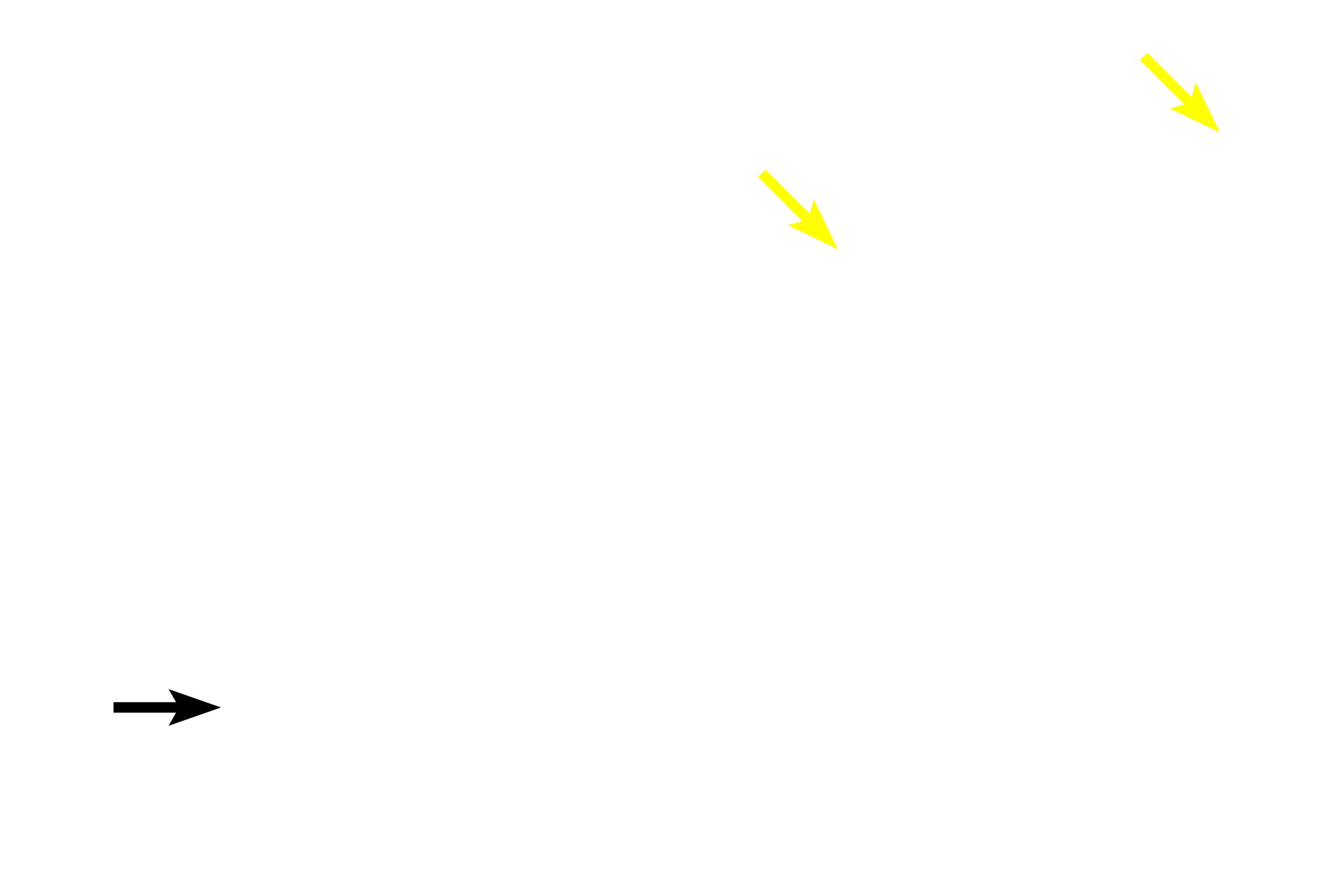Lymph capillaries >  <p>Lymph capillaries begin as blind-ended tubes in the lamina propria of peripheral organs and resemble blood capillaries, formed by a single layer of endothelial cells.  Lymphatic capillaries come together to form larger lymph vessels that acquire additional layers of smooth muscle and connective tissue. Lymph vessels possess valves, flaps formed by the inner lining, to prevent backflow of the fluid.  Lymph vessels drain into lymph nodes located along their length.</p>
