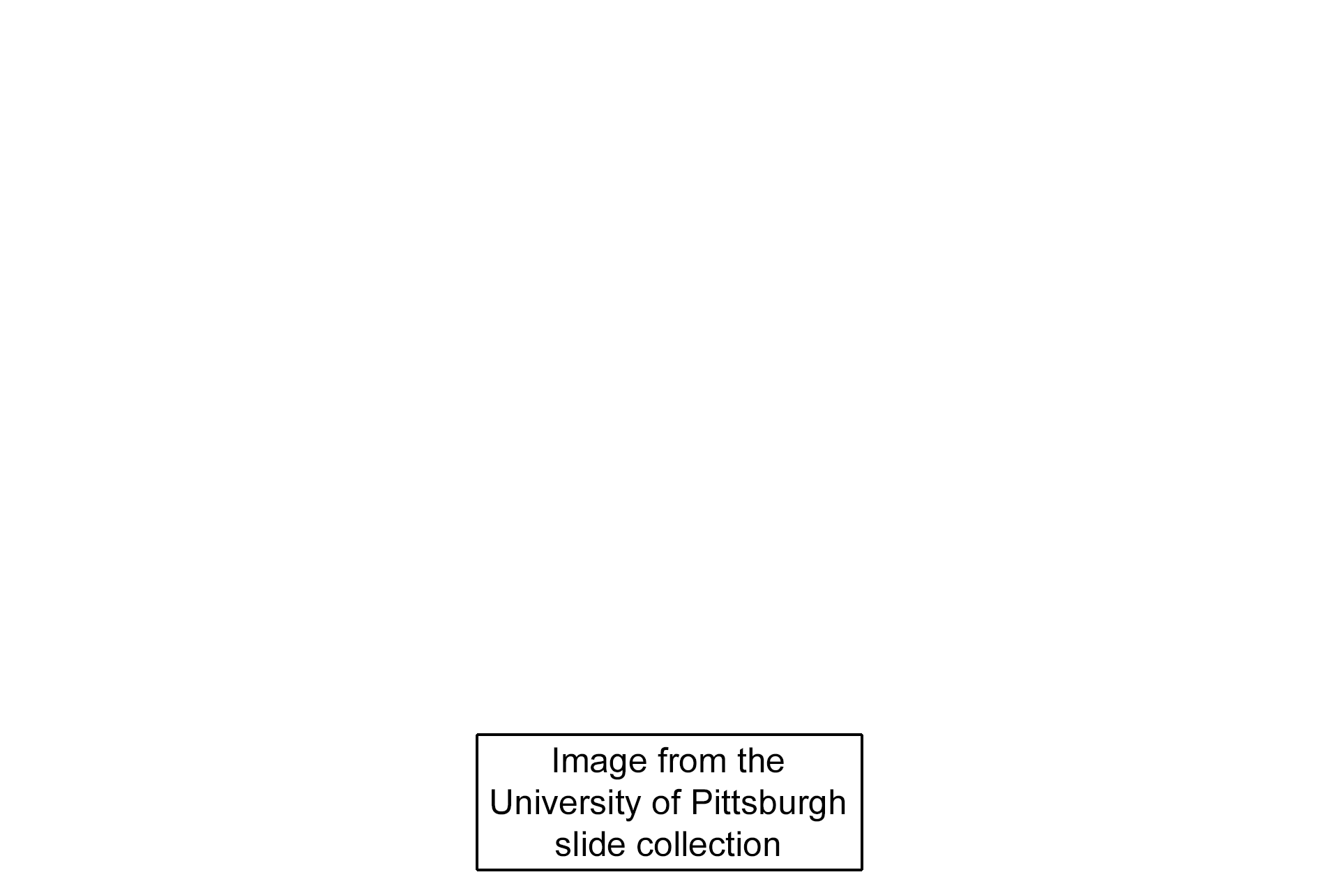 Image credit > <p>This image was taken of a slide in the University of Pittsburgh slide collection.</p>
