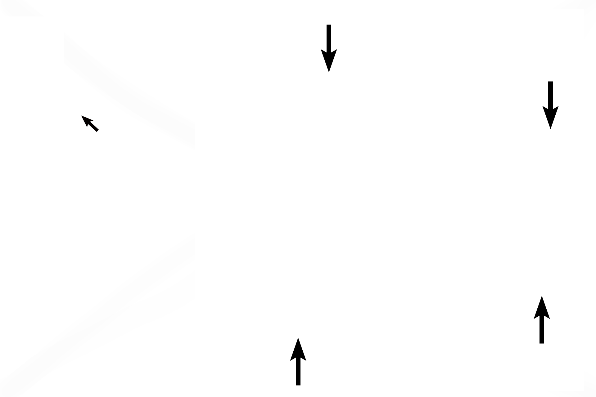  - Scrotum <p>The testis develops retroperitoneally in the abdomen, and descends into the scrotum. It is covered anteriorly, medially and laterally by peritoneum (serosa), which is called tunica vaginalis.  The visceral portion of the tunica (black arrows) overlies tunica albuginea, while the parietal portion (red arrows) lines the internal scrotal wall.  Processes vaginalis (X), former peritoneal space, separates the two tunics. </p>
