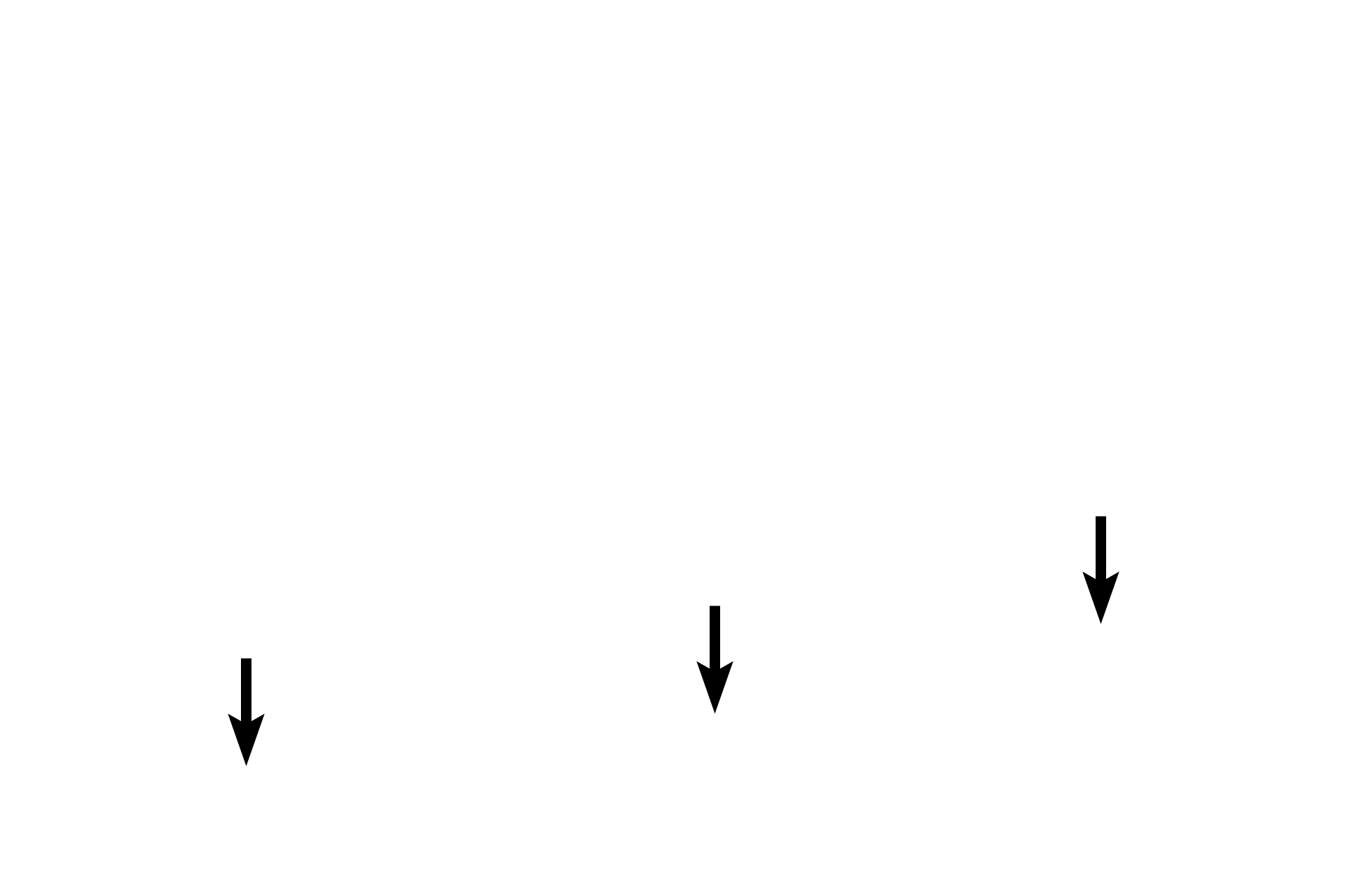 Tunica vaginalis - parietal layer <p>The processes vaginalis is a remnant of the peritoneal space that precedes the testis during its descent into the scrotum.  The space is lined by the tunica vaginalis, a serous membrane, with visceral and parietal layers.  Like all serosas, the tunica vaginalis is composed of connective tissue covered by a mesothelium (simple squamous epithelium). The parietal layer lines the inner surface of the scrotum; the visceral layer covers the tunica albuginea, the dense connective tissue surrounding the testis proper. Immature testis, 100x</p>
