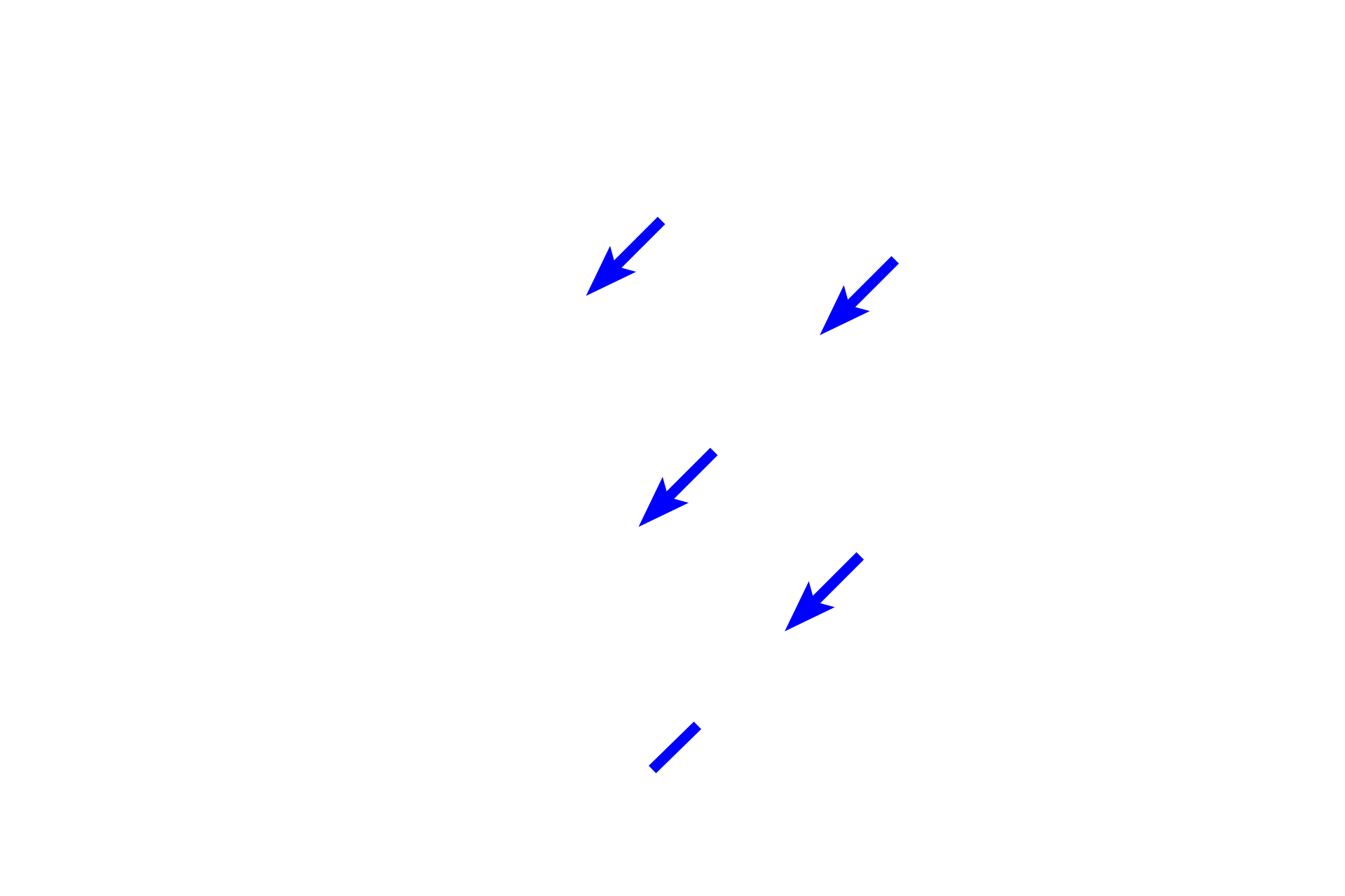 Cementum > <p>Cementum is the calcified tissue layer on the surface of the root. It is less mineralized than dentin, roughly 50% organic matrix (cementoid) and 50% hydroxyapatite; similar to bone. Cementum functions to attach the tooth to the tooth socket by anchoring the periodontal ligament.  Cementum also seals the ends of the dentin tubules and allows for repair at the tooth root. </p>
