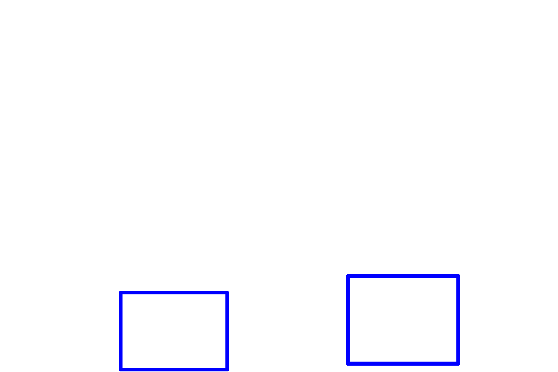 Developing mandible <p>This image shows the developing fetal face between 6-8 weeks of gestation. In the primordial jaw, the ectoderm begins to thicken forming a dental lamina in the medial aspect of the primordial oral cavity and a vestibular lamina in its lateral aspect. 10x</p>
