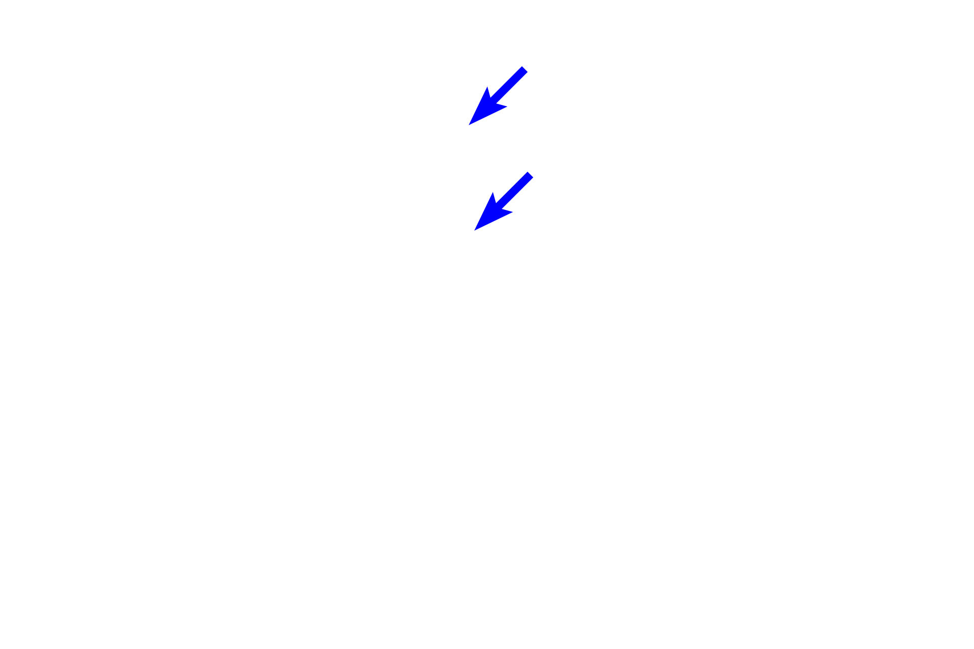 Nasal septum <p>This image shows the developing fetal face between 6-8 weeks of gestation. In the primordial jaw, the ectoderm begins to thicken forming a dental lamina in the medial aspect of the primordial oral cavity and a vestibular lamina in its lateral aspect. 10x</p>
