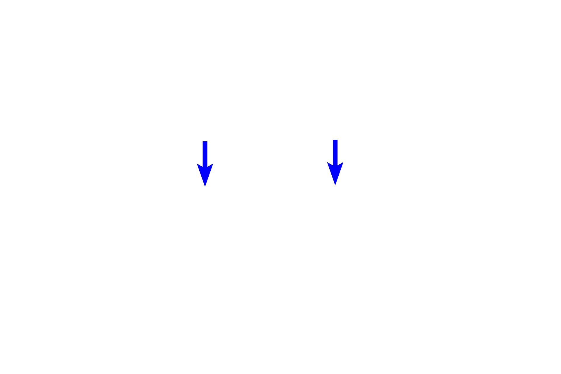 Palate <p>This image shows the developing fetal face between 6-8 weeks of gestation. In the primordial jaw, the ectoderm begins to thicken forming a dental lamina in the medial aspect of the primordial oral cavity and a vestibular lamina in its lateral aspect. 10x</p>
