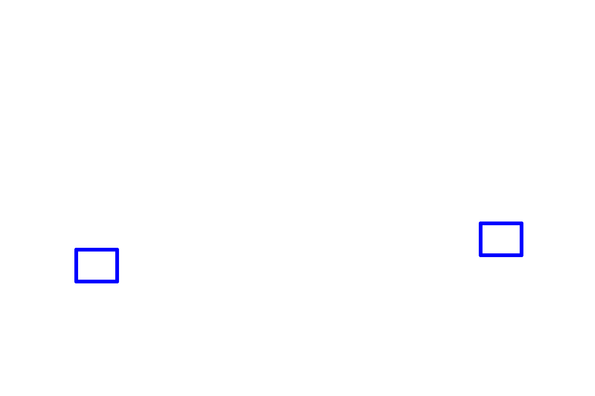 Vestibular lamina > <p>The vestibular lamina is a thickening of the ectoderm in the lateral aspect of the primordial oral cavity. This infolding develops into the vestibule of the oral cavity.</p>
