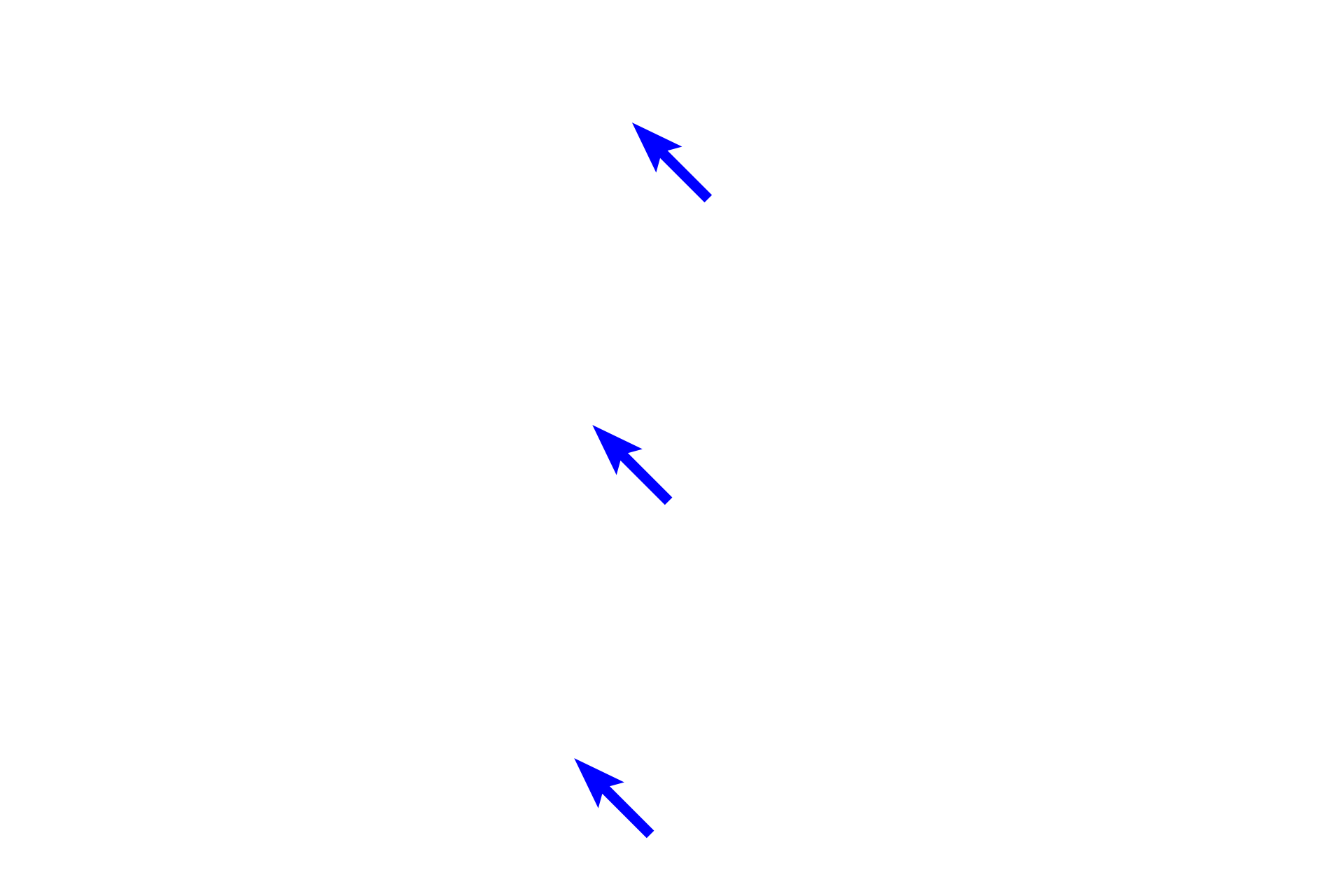  - Ameloblasts <p>The green shading in this image indicates the location of enamel, which is lost during tissue preparation in this demineralized specimen.   Enamel is produced by ameloblasts that secrete an organic matrix that quickly becomes mineralized with hydroxyapatite crystals of calcium phosphate.</p>
