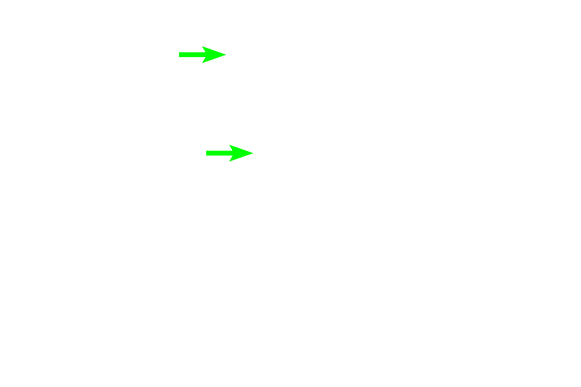 Ameloblasts > <p>The columnar ectodermal cells on the inner aspect of the enamel organ that deposit the organic matrix of enamel are fully differentiated ameloblasts. During the crown stage of tooth development the pre-ameloblasts fully differentiate into ameloblasts that deposit enamel starting at the cusp of the tooth and moving apically. Ameloblasts have a shovel-shaped process at their base called Tomes process, that is visible in this micrograph as a light line </p>
