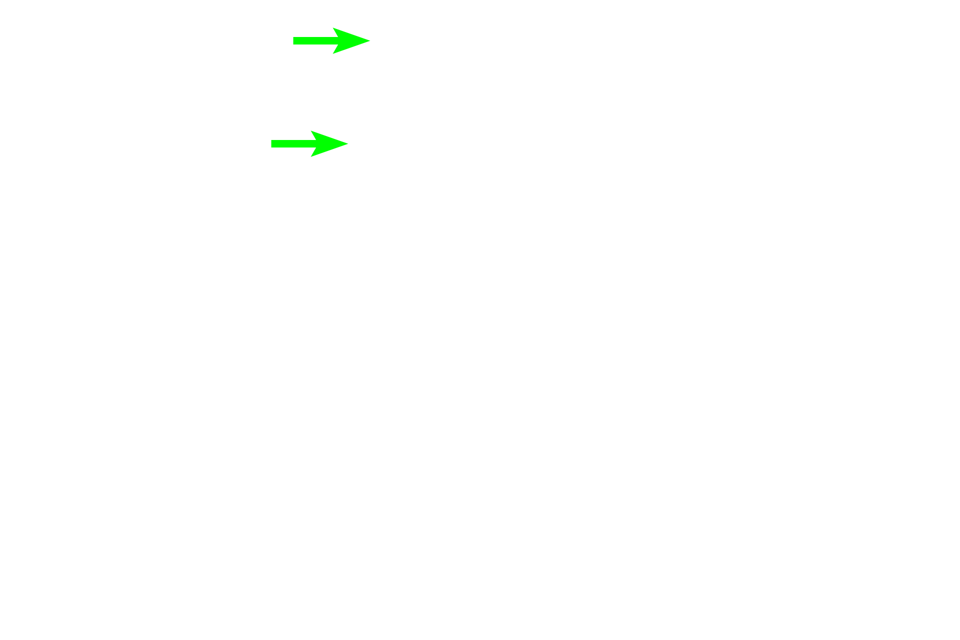 Gingiva <p>Root development occurs after crown formation and determines the eventual shape of the root.  The area of the image on the right is indicated by the rectangle in the image to the left.  10x, 400x</p>
