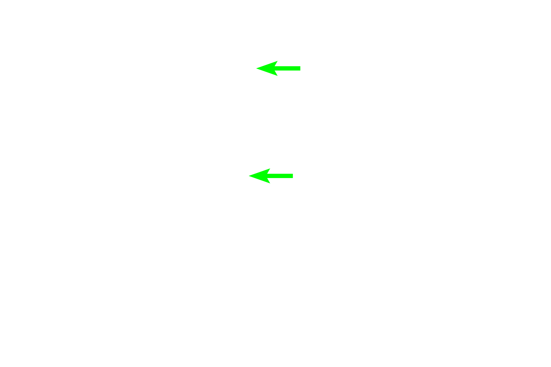 Odontoblasts > <p>Odontoblasts deposit the organic matrix of dentin (predentin) which rapidly becomes mineralized by hydroxyapatite, forming dentin.</p>
