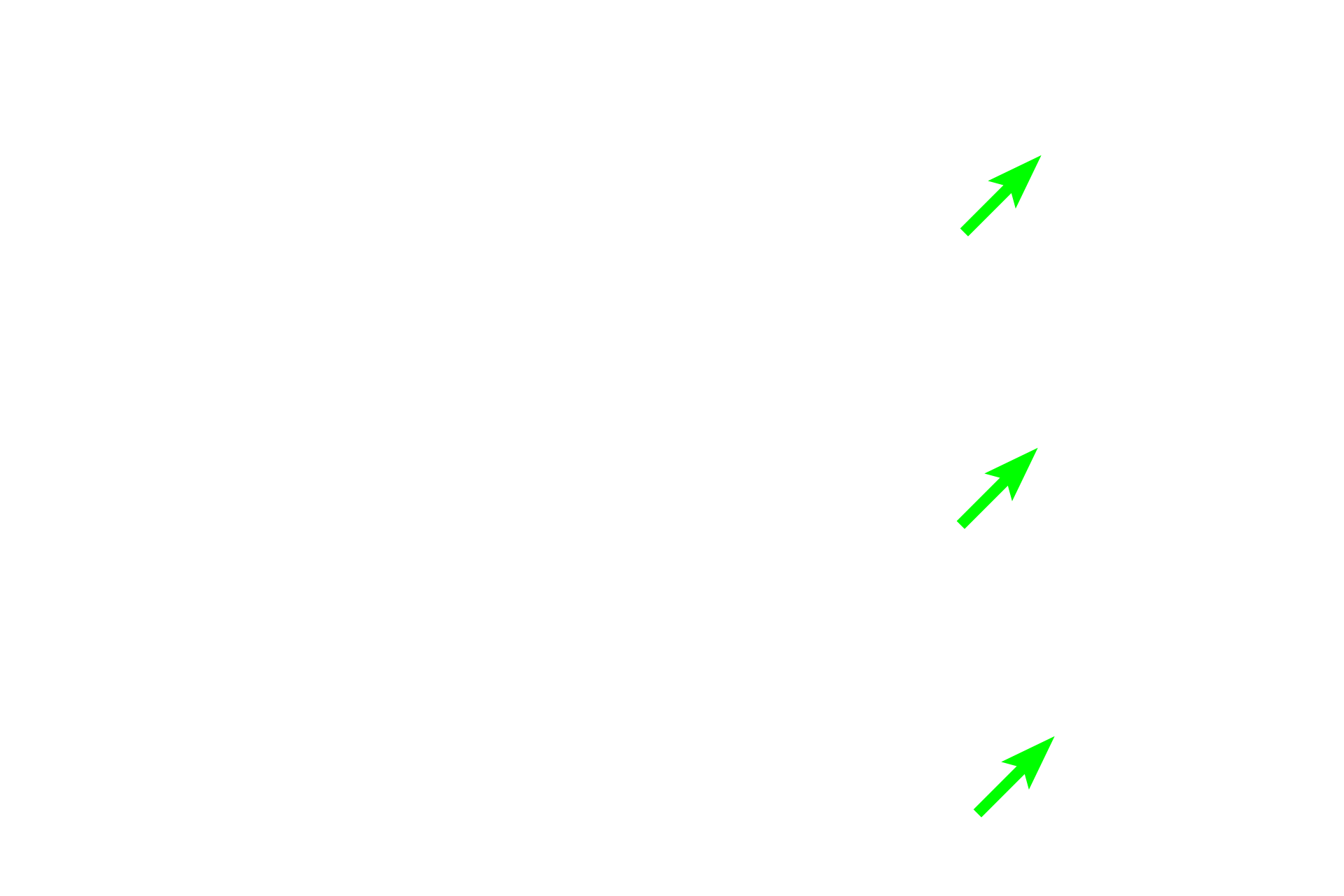  - Predentin <p>Odontoblasts line the pulp cavity and deposit dentin similarly to bone.  The organic matrix, called predentin, is deposited first and provides a framework on which hydroxyapatite crystals are laid down. Mineralized dentin is more darkly stained.  A layer of pre-dentin is present throughout the life of the tooth.</p>
