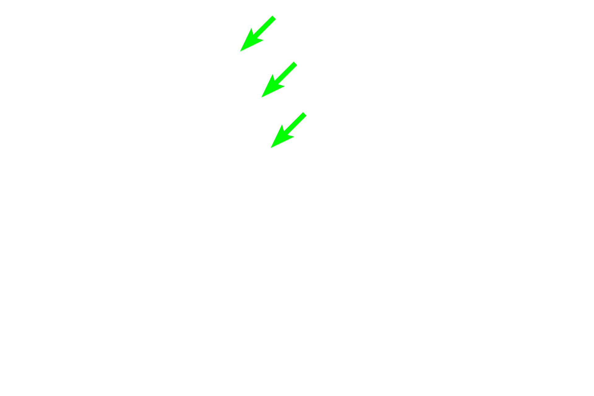 - Tomes' processes <p>The columnar ectodermal cells on the inner aspect of the enamel organ that deposit the organic matrix of enamel are fully differentiated ameloblasts. During the crown stage of tooth development the pre-ameloblasts fully differentiate into ameloblasts that deposit enamel starting at the cusp of the tooth and moving apically. Ameloblasts have a shovel-shaped process at their base called Tomes process, that is visible in this micrograph as a light line. </p>
