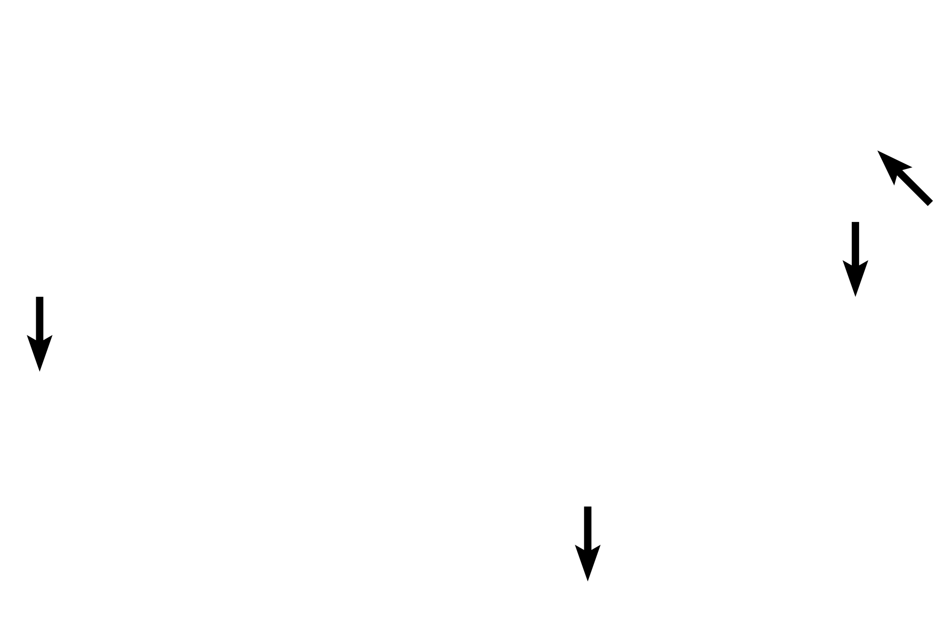 Adventitia <p>For most of its length, the esophagus is attached to the posterior body wall and does not protrude into the thoracic cavity. Thus the outer tunic is an adventitia of connective tissue. </p>
