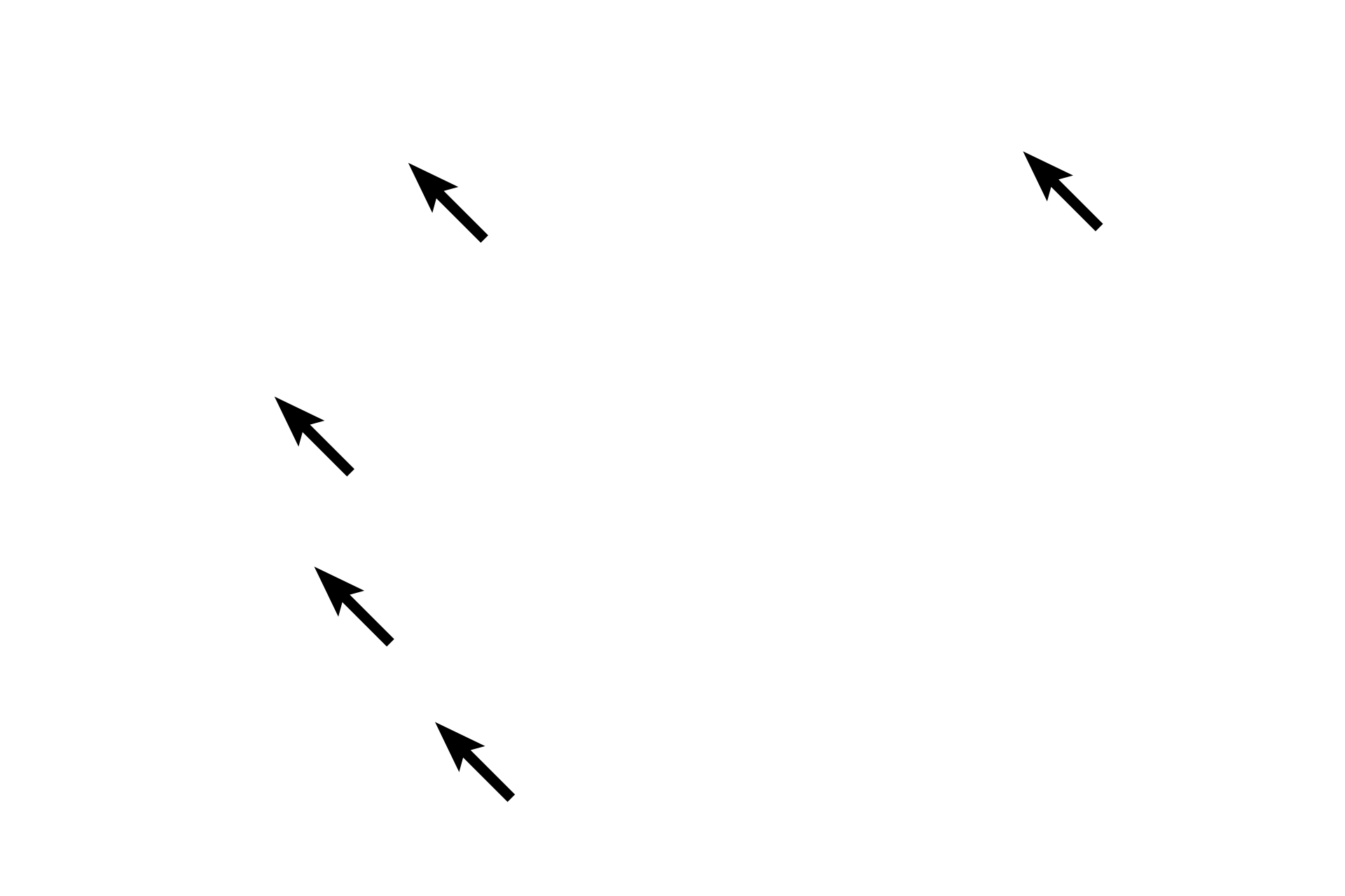 Ceruminous glands <p>Elastic cartilage, continuous with that of the auricle, supports the auditory meatus in its outer third, while the support of the inner two-thirds is provided by the temporal bone. Typical thin skin, possessing many hairs, sebaceous and ceruminous glands, lines the external auditory meatus. 40x</p>

