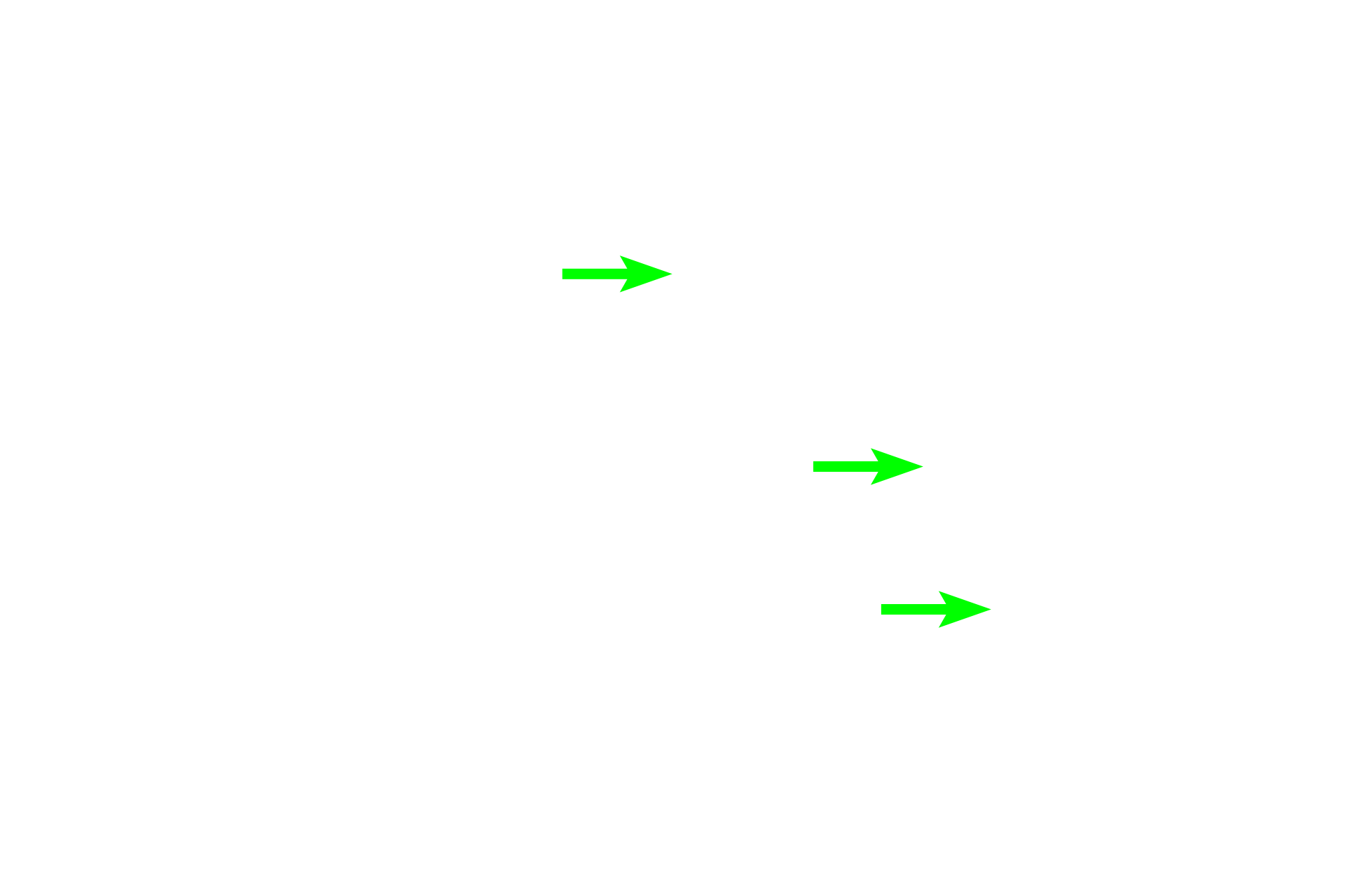 Sebaceous glands <p>The thin skin lining the external meatus possesses hair follicles with large sebaceous glands. Also present are ceruminous glands, specialized apocrine sweat glands that produce a waxy secretion called cerumen. 100x</p>
