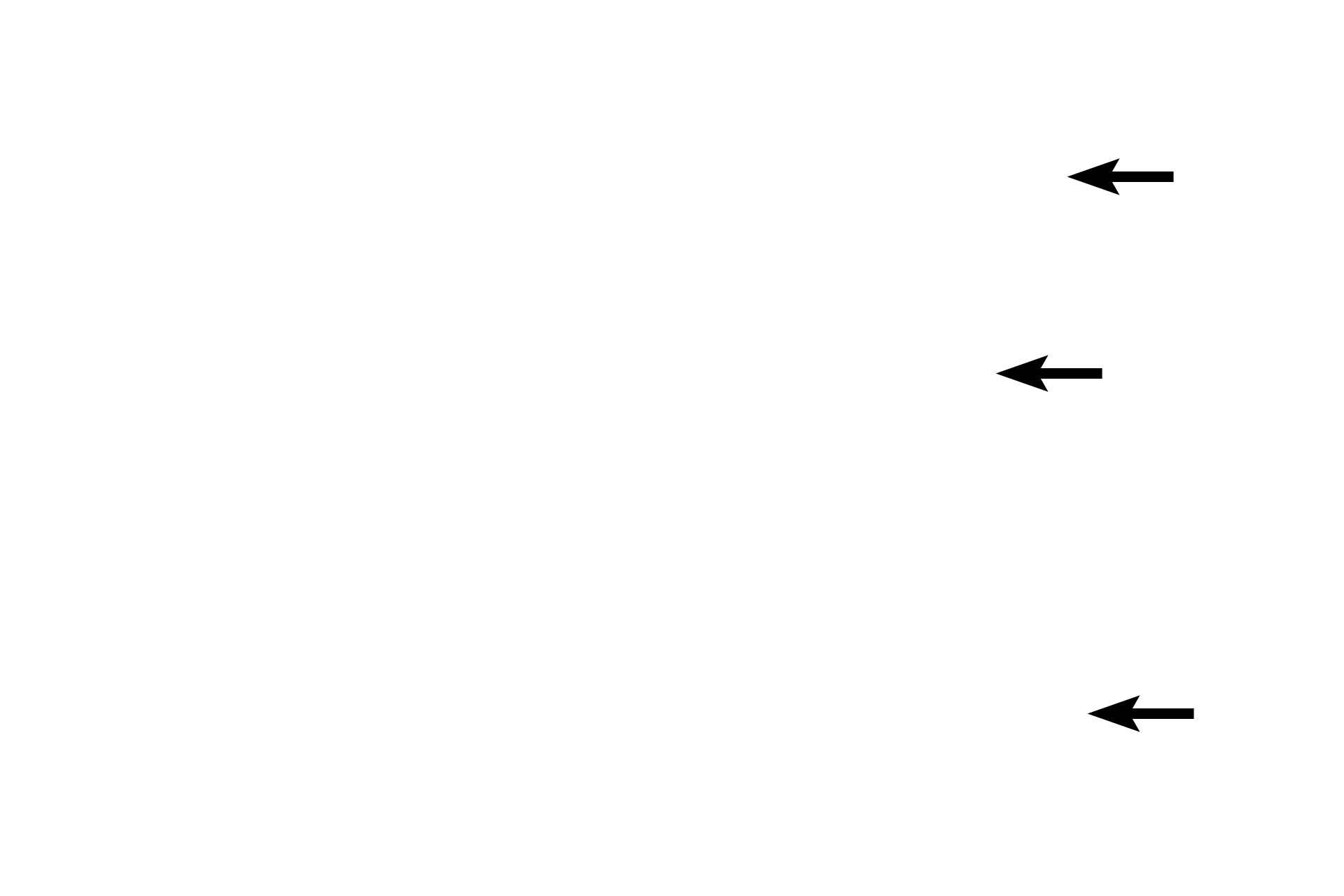  - Elastic cartilage <p>The auricle, or pinna, consists of an inner skeleton of elastic cartilage covered by a layer of thin skin.</p>
