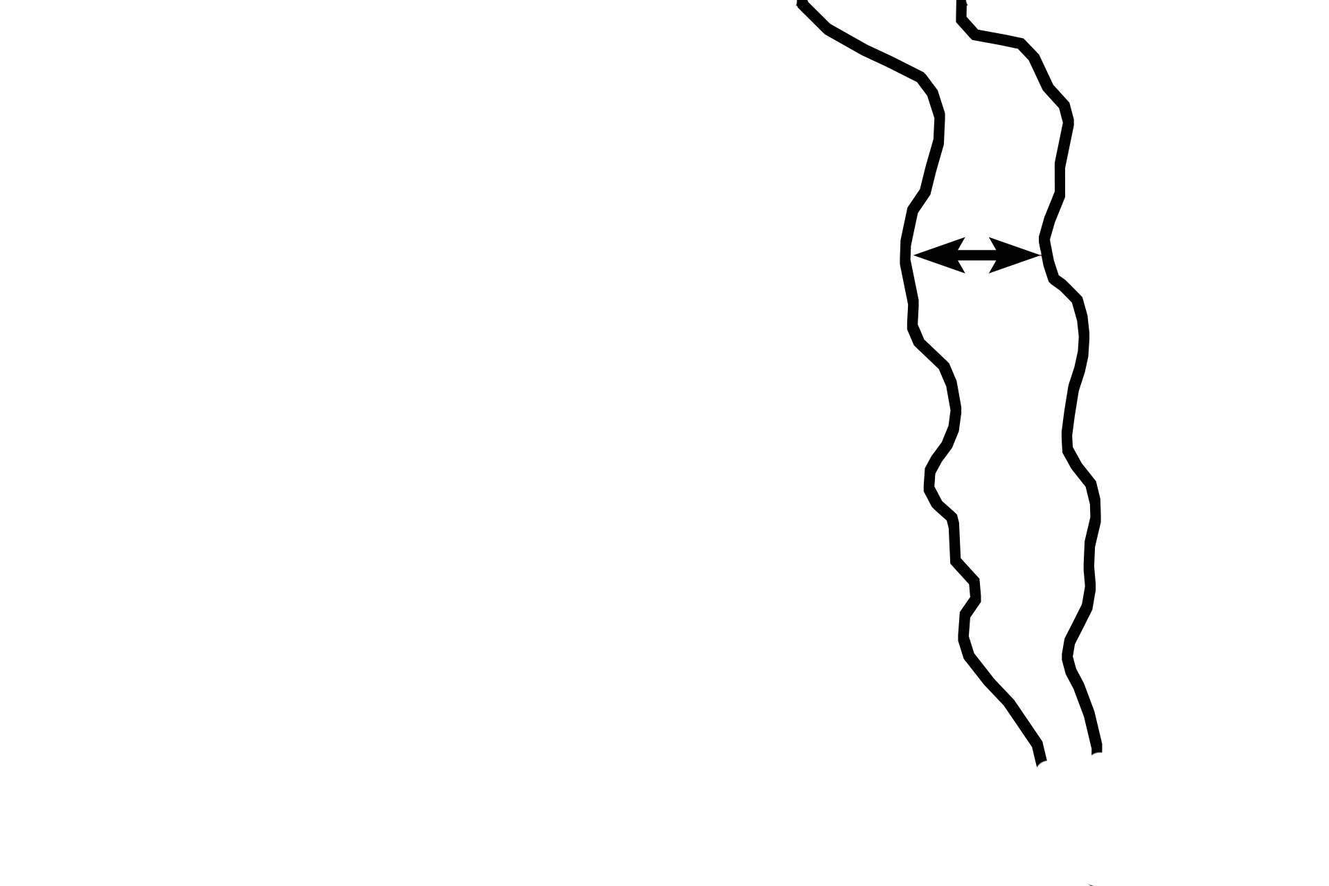 Zone of degeneration <p>This image demonstrates the entire zonation of the epiphyseal plate. The image is a 90-degree counter-clockwise rotation of the previous images. 200x</p>
