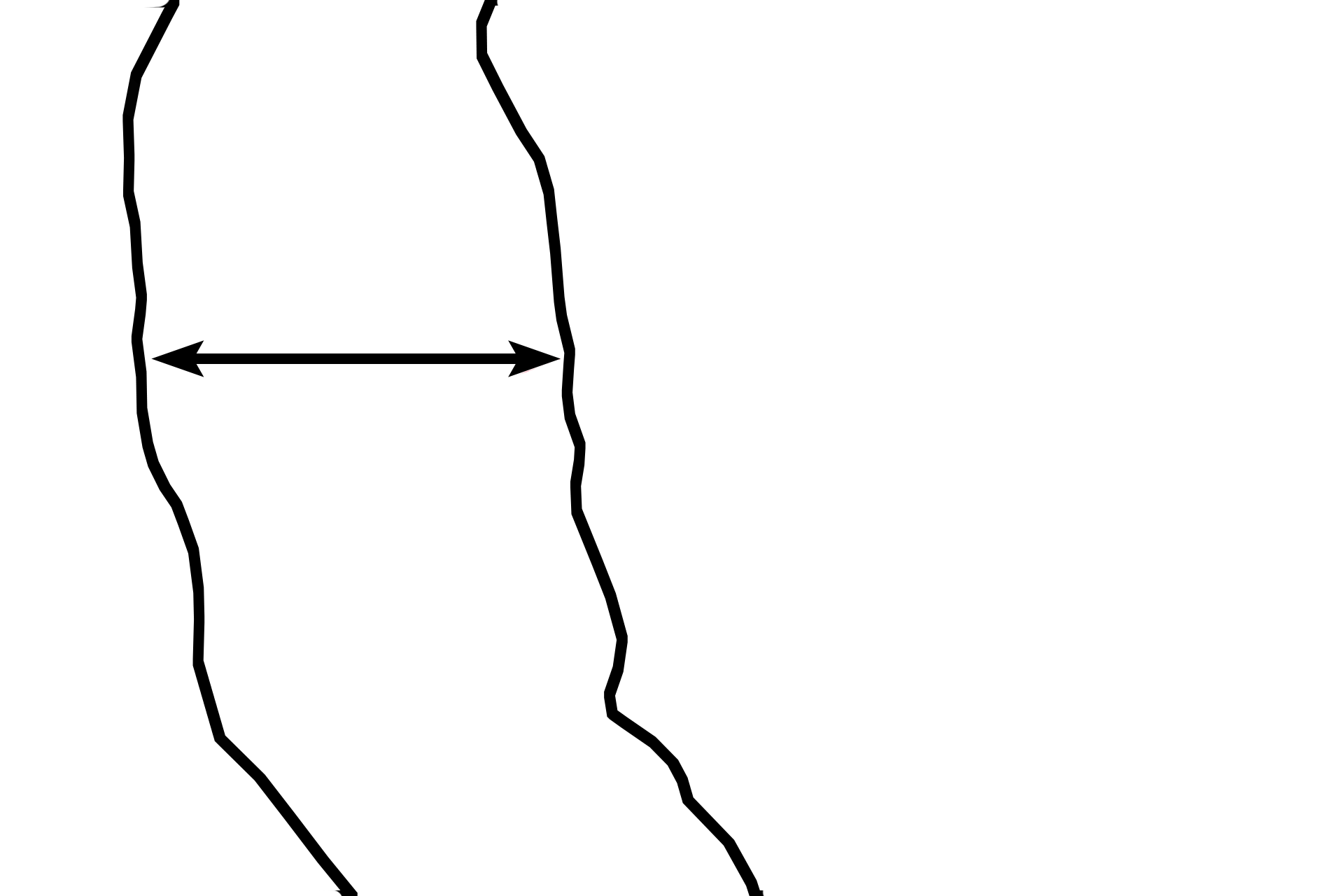 Zone of proliferation <p>This image demonstrates the entire zonation of the epiphyseal plate. The image is a 90-degree counter-clockwise rotation of the previous images. 200x</p>
