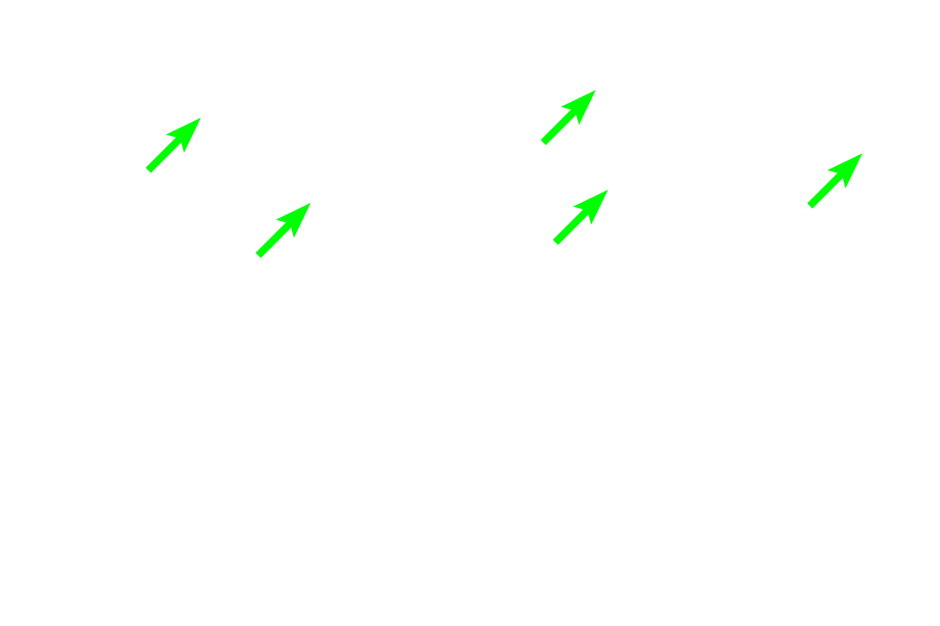 Spongy bone > <p>Spongy bone is found in the interior of the bone, filling the epiphyses and lining the compact bone in the diaphysis. Red marrow fills the spaces of spongy bone in the epiphyses.</p>
