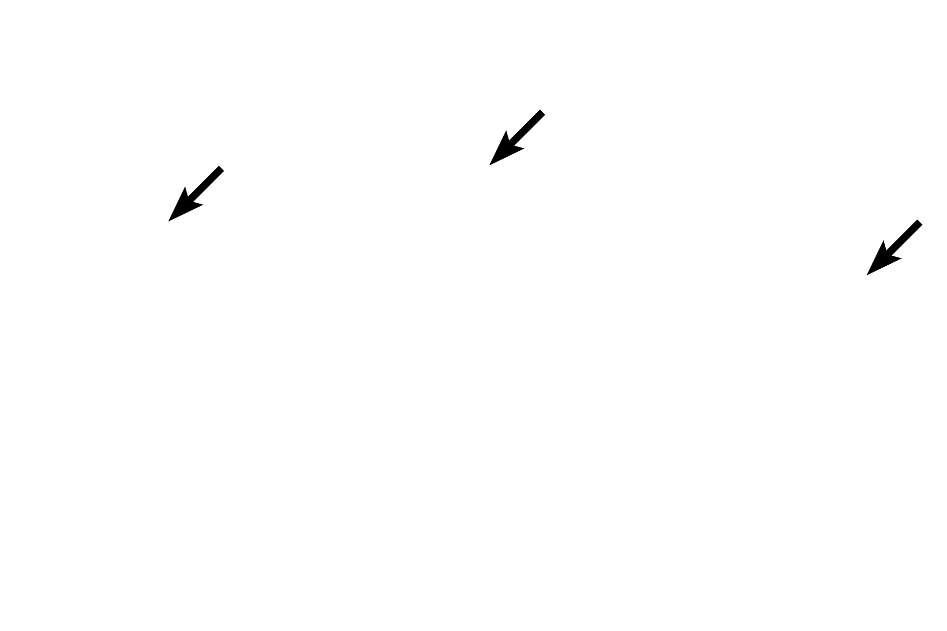  - Periosteal collar <p>Three metacarpal bones of the fetal hand have been cut in cross section at different distances from the epiphyseal plate, showing the gradual resorption of bony spicules.  On the left, numerous spicules are present, indicating a region close to the epiphyseal plate.  On the right, few spicules remain, demonstrating an area closer to the mid-diaphysis. 10x</p>
