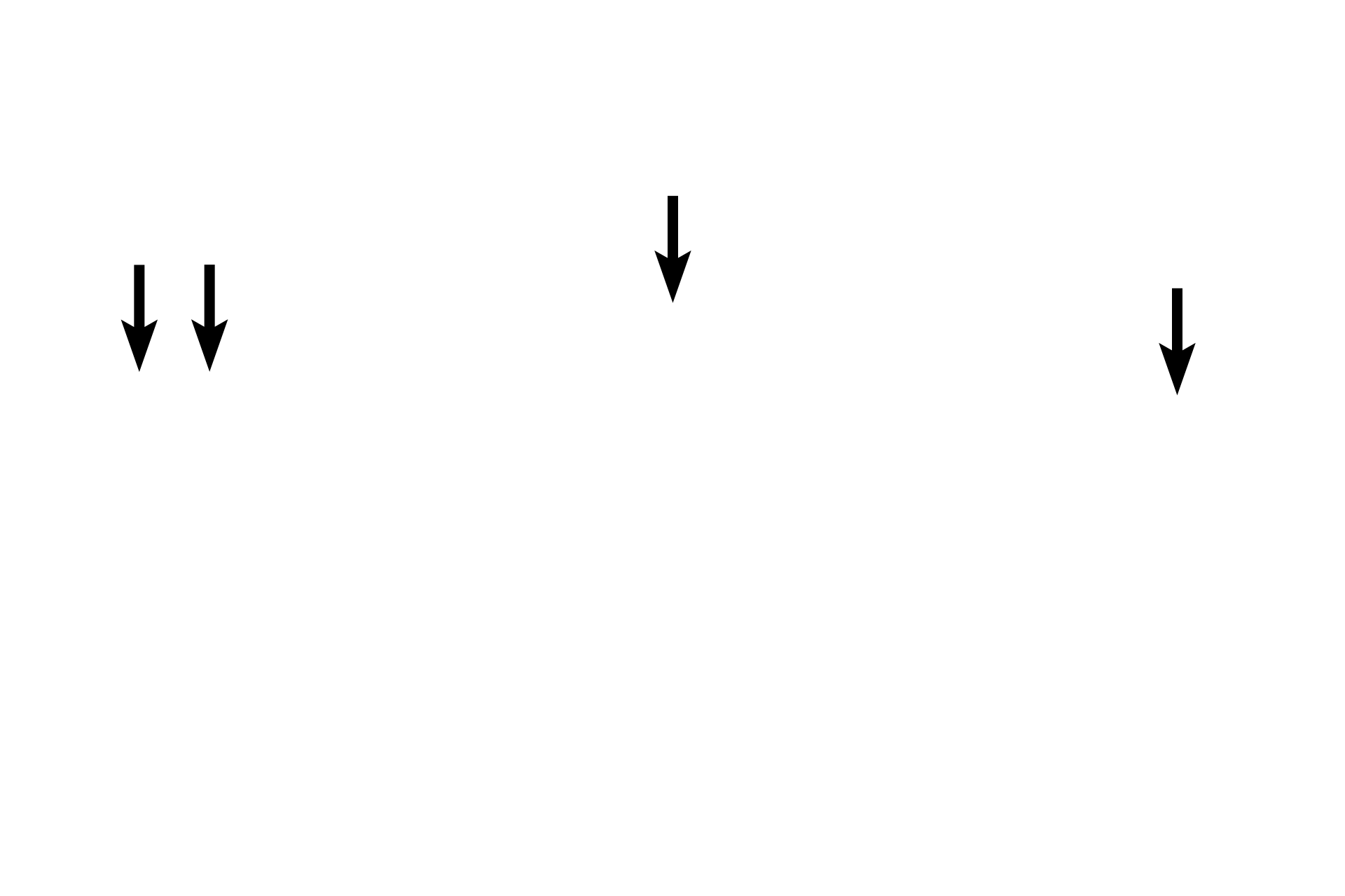  - Spicules <p>Three metacarpal bones of the fetal hand have been cut in cross section at different distances from the epiphyseal plate, showing the gradual resorption of bony spicules.  On the left, numerous spicules are present, indicating a region close to the epiphyseal plate.  On the right, few spicules remain, demonstrating an area closer to the mid-diaphysis. 10x</p>
