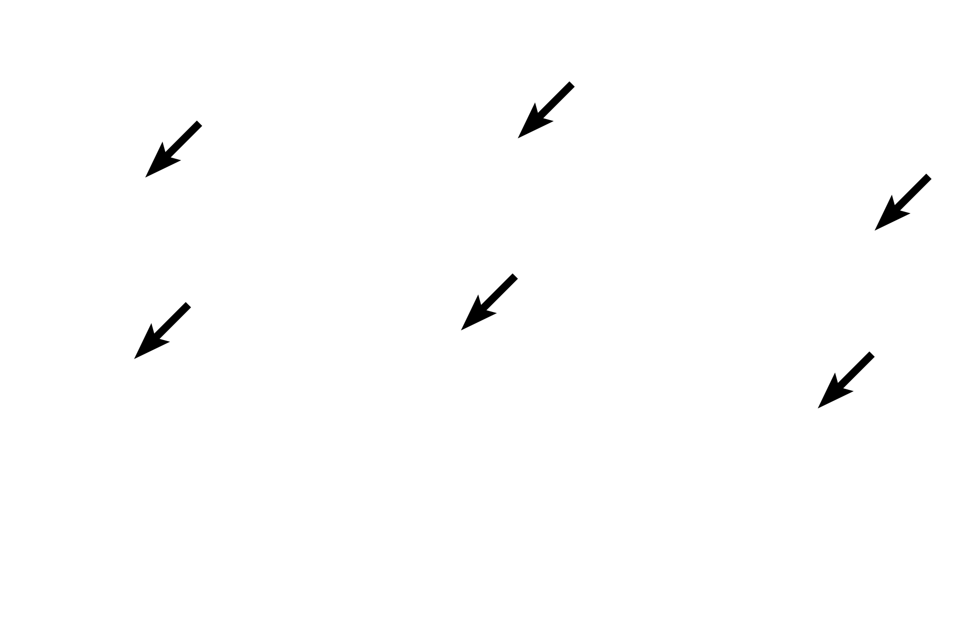 Muscle tendons <p>Three metacarpal bones of the fetal hand have been cut in cross section at different distances from the epiphyseal plate, showing the gradual resorption of bony spicules.  On the left, numerous spicules are present, indicating a region close to the epiphyseal plate.  On the right, few spicules remain, demonstrating an area closer to the mid-diaphysis. 10x</p>
