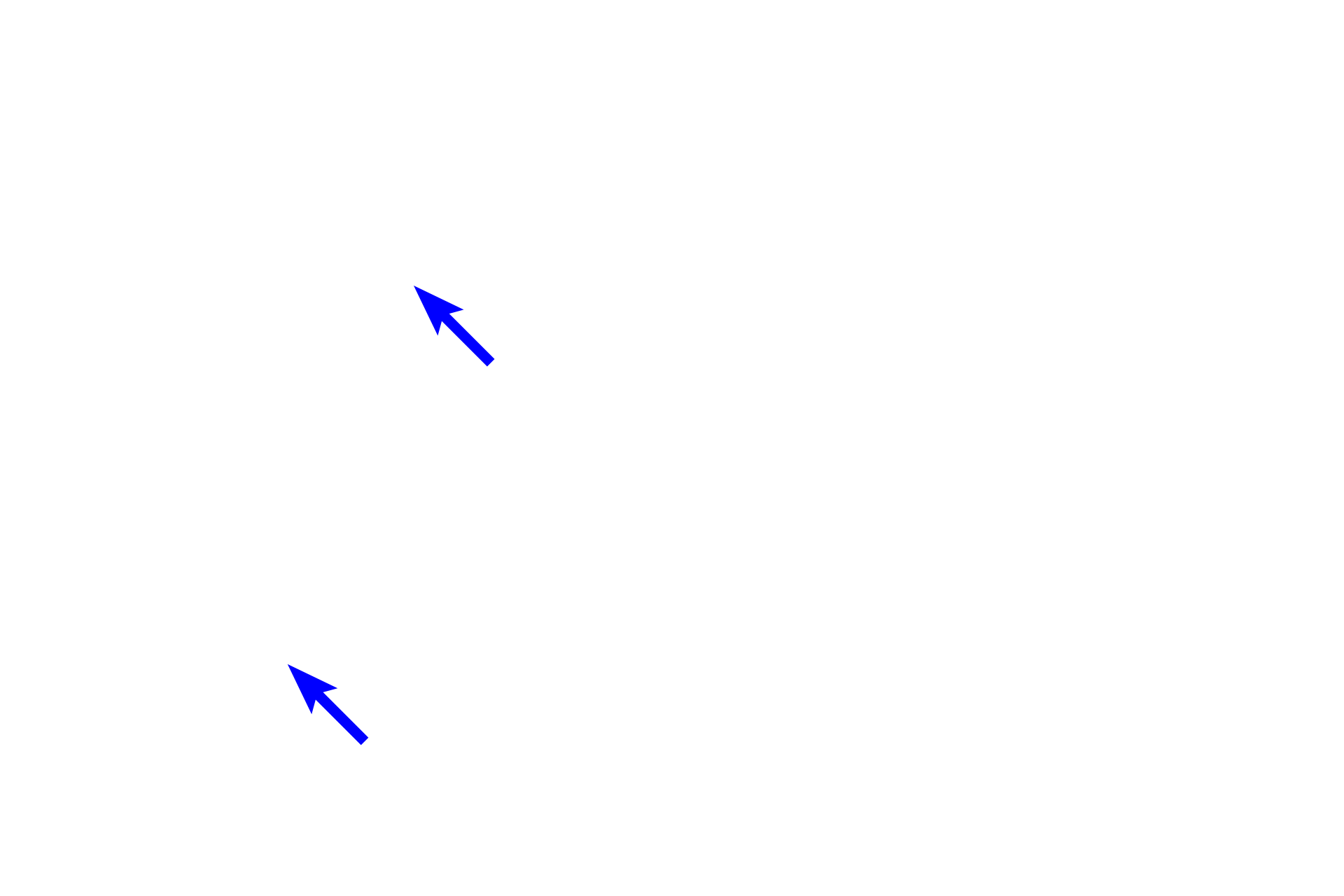  - Bone <p>The blue-staining central cores of the spicules are composed of calcified cartilage formed by the chondrocytes in the epiphyseal plate. These cores form a framework upon which bone is deposited by osteoblasts. The absence of osteoclasts in the endosteum surrounding the spicule indicates that it is located in the zone of ossification.</p>
