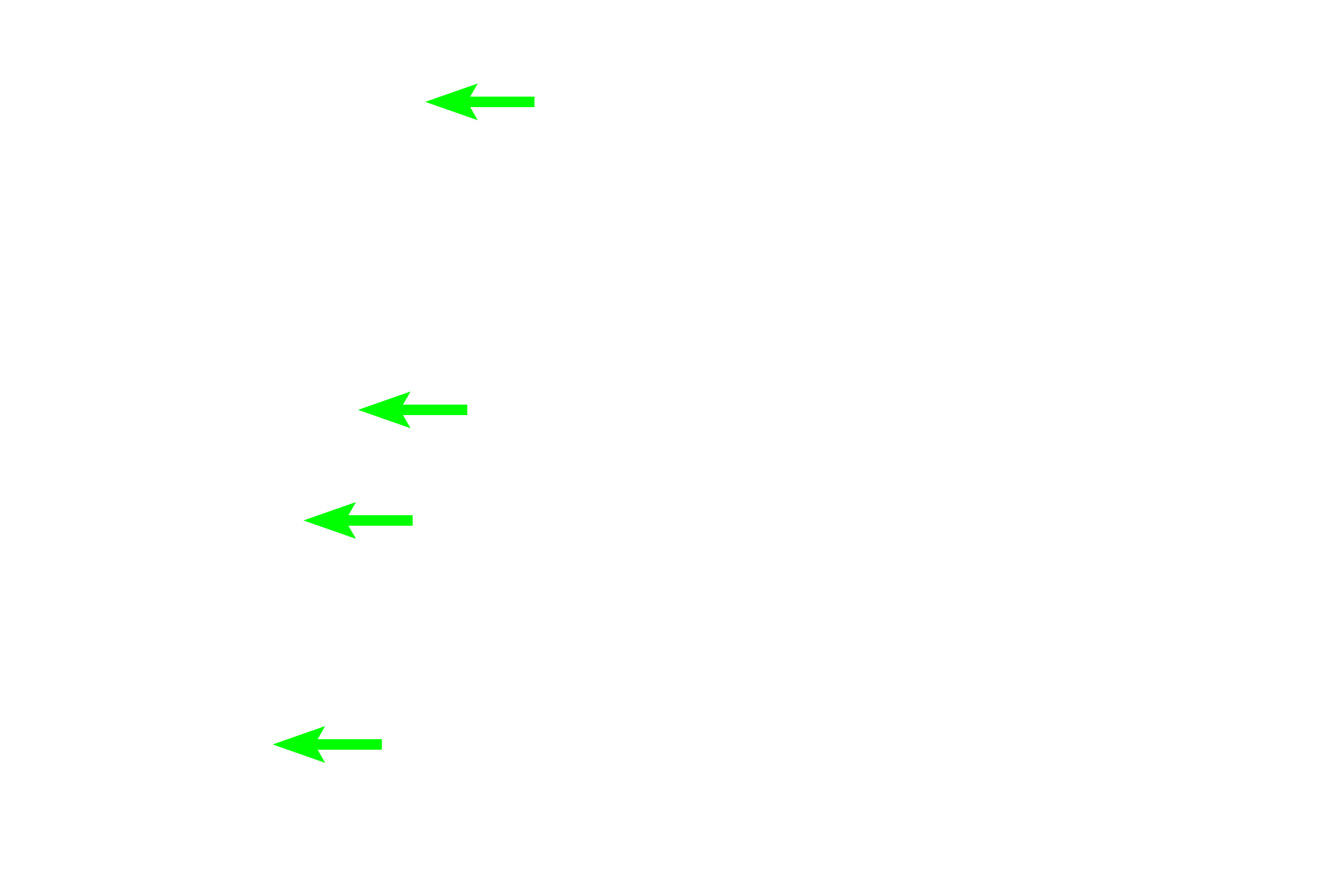  - Calcified cartilage <p>The blue-staining central cores of the spicules are composed of calcified cartilage formed by the chondrocytes in the epiphyseal plate. These cores form a framework upon which bone is deposited by osteoblasts. The absence of osteoclasts in the endosteum surrounding the spicule indicates that it is located in the zone of ossification.</p>
