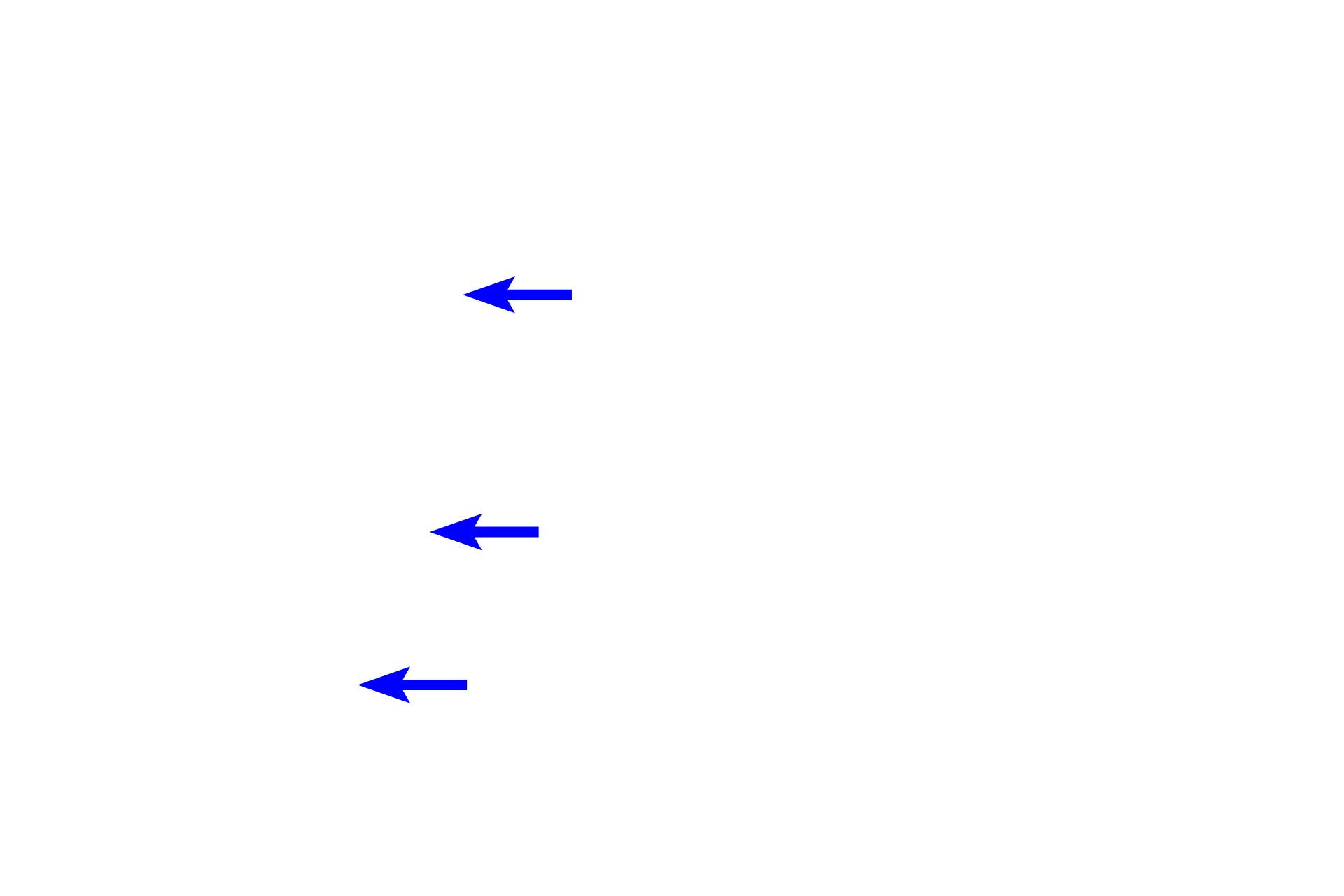  - Osteoblasts <p>The blue-staining central cores of the spicules are composed of calcified cartilage formed by the chondrocytes in the epiphyseal plate. These cores form a framework upon which bone is deposited by osteoblasts. The absence of osteoclasts in the endosteum surrounding the spicule indicates that it is located in the zone of ossification.</p>
