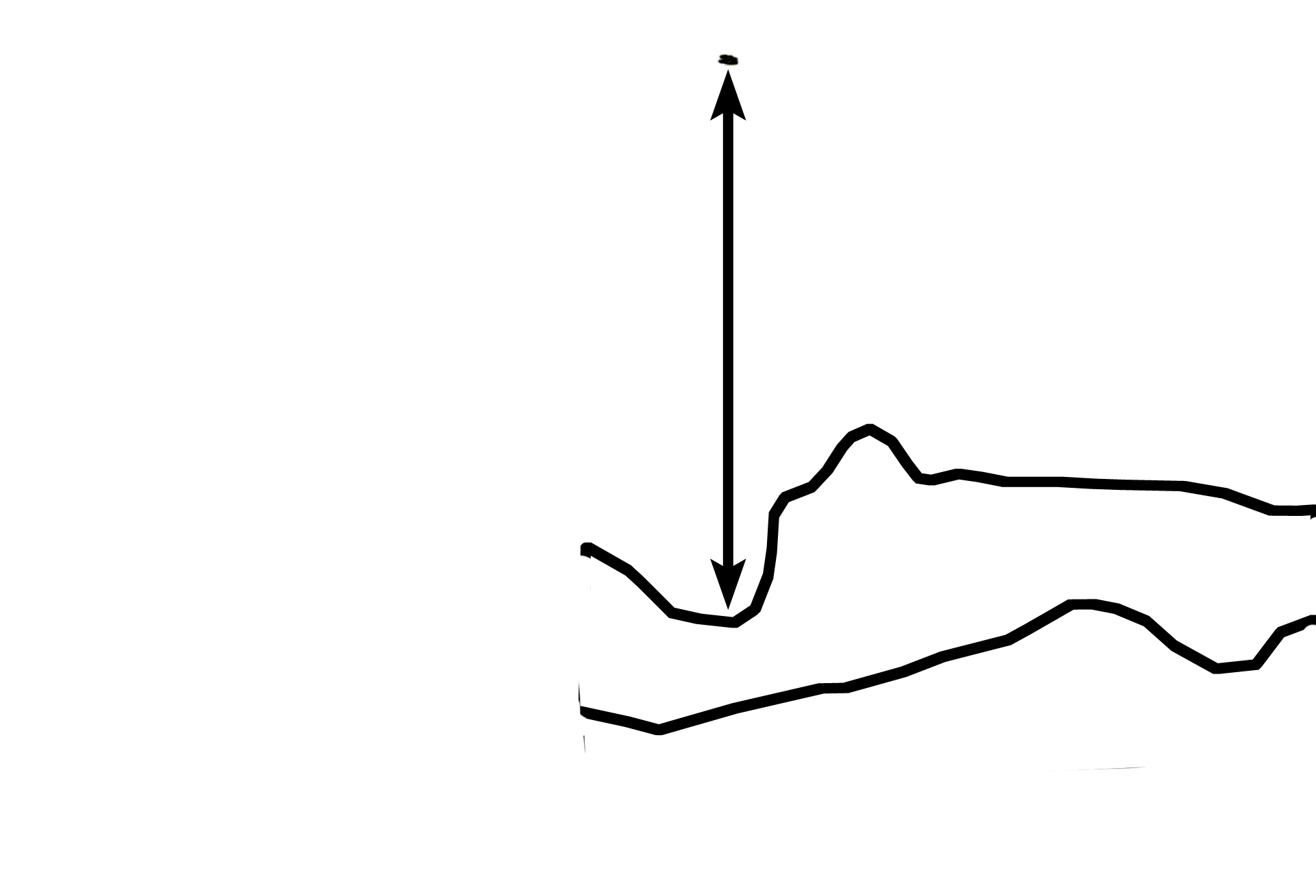 Zones of M-H-C > <p>In the zone of maturation-hypertrophy-calcification (arrow) [M-H-C], chondrocytes begin to mature, hypertrophy and secrete alkaline phosphatase into the matrix. An alkaline environment encourages the calcification of the cartilage matrix, thus prohibiting diffusion of nutrients to the chondrocytes.</p>
