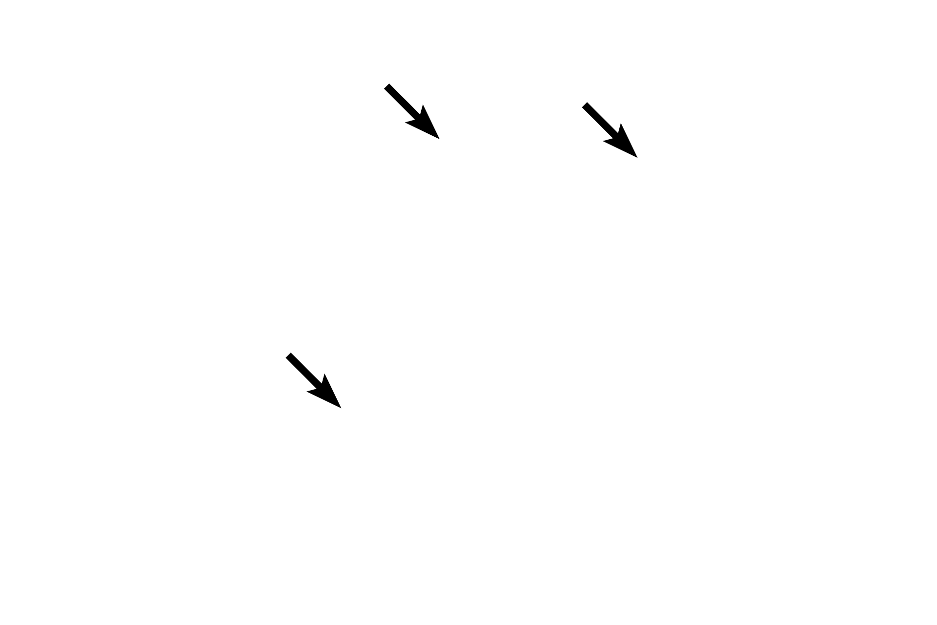 Hair follicles <p>Elastic cartilage, continuous with that of the auricle, supports the auditory meatus in its outer third, while the support of the inner two-thirds is provided by the temporal bone. Typical thin skin, possessing many hairs, sebaceous and ceruminous glands, lines the external auditory meatus. 40x</p>
