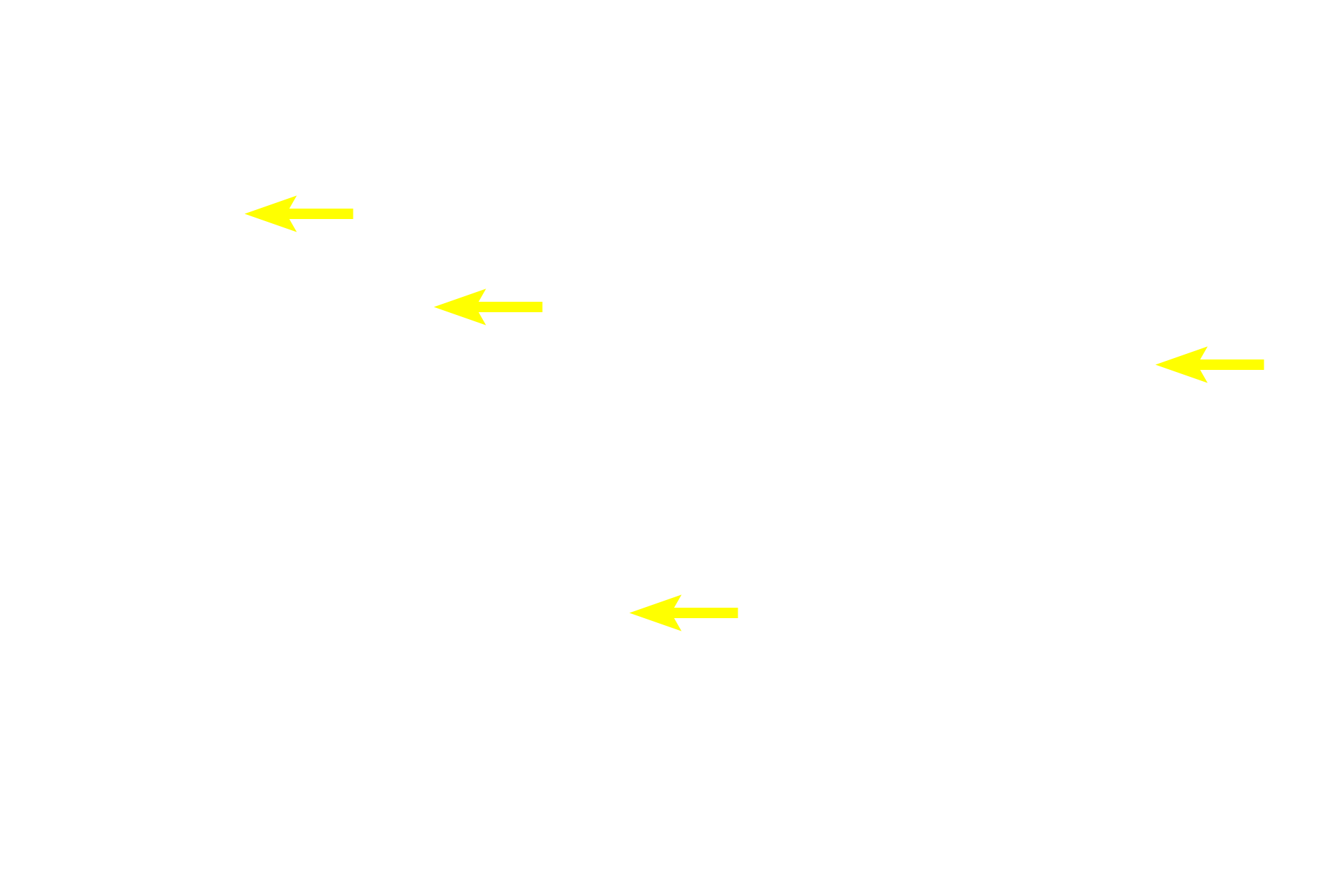  - Lamina propria <p>A trichrome stain of the mucosa and submucosa of the esophagus emphasizes the different tissues present.  In this region the muscularis mucosae is incomplete, consisting of islands of smooth muscle, rather than a continuous layer.  The longitudinal fold, with a core of submucosa, would flatten during expansion of the esophagus during food transport.  40x</p>
