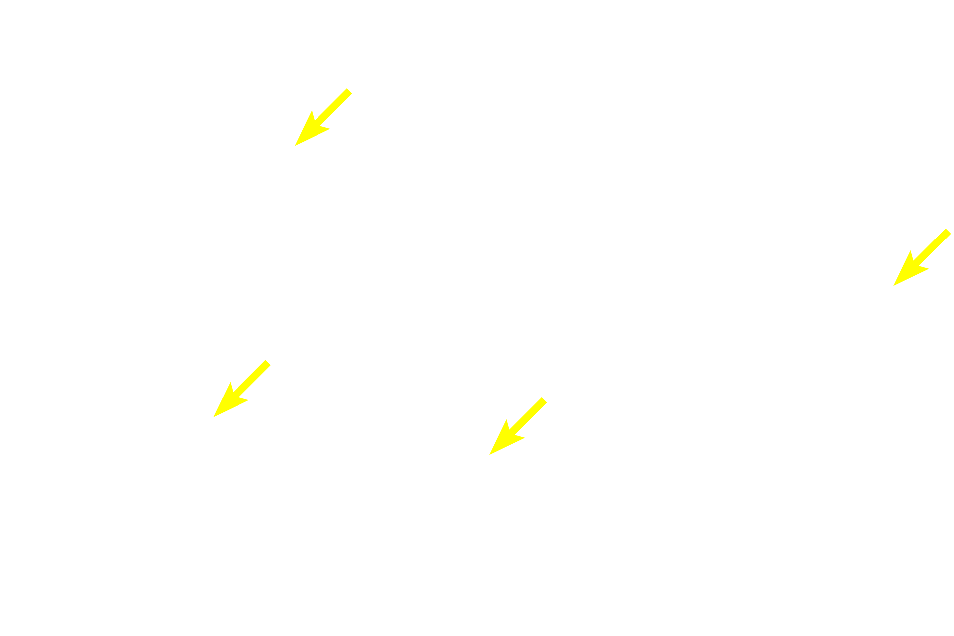  - Muscularis mucosae <p>A trichrome stain of the mucosa and submucosa of the esophagus emphasizes the different tissues present.  In this region the muscularis mucosae is incomplete, consisting of islands of smooth muscle, rather than a continuous layer.  The longitudinal fold, with a core of submucosa, would flatten during expansion of the esophagus during food transport.  40x</p>
