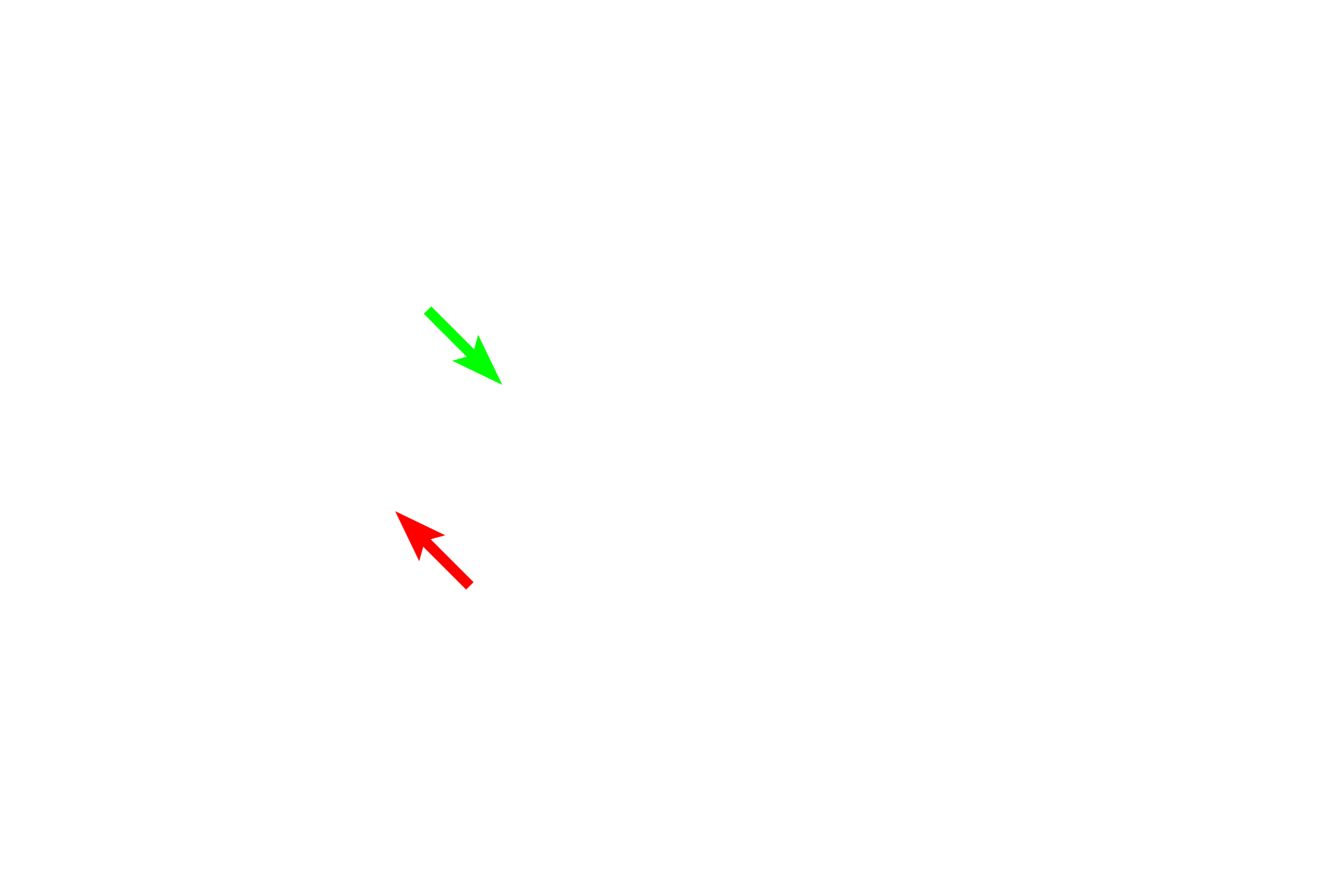 Windows > <p>Two openings connect inner and middle ears. The oval window (green arrow), in the lateral wall of the vestibule, is occupied by the foot plate of the stapes, where sound vibrations are transmitted to the perilymph. The round window (red arrow), located in the cochlea, is covered by a membrane that bulges into the middle ear, cushioning pressure created in the perilymph by movement of the stapes.</p>
