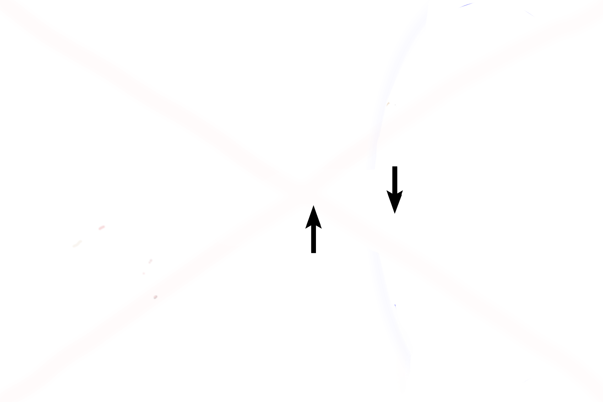  - External meatus <p>A frontal view of the left ear demonstrates components of the outer ear and middle ear. The inner ear is embedded in the petrous portion of the temporal bone, that forms part of the floor of the cranial cavity.</p>
