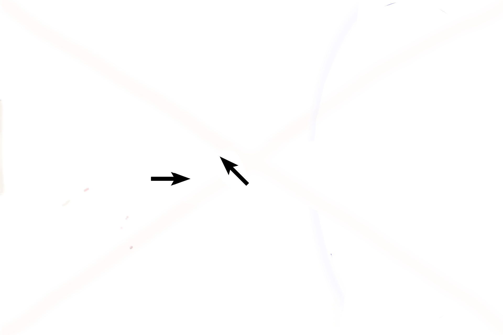  - Tympanic membrane <p>A frontal view of the left ear demonstrates components of the outer ear and middle ear. The inner ear is embedded in the petrous portion of the temporal bone, that forms part of the floor of the cranial cavity.</p>
