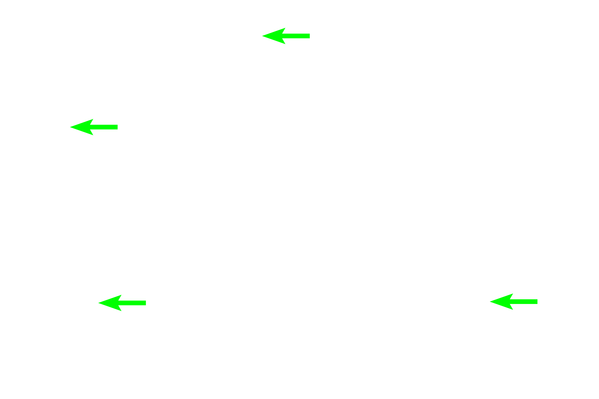 - Myenteric plexus <p>The muscularis externa is formed of inner circular and outer longitudinal layers. The myenteric plexus (Auerbach’s plexus), a component of the autonomic nervous system, is located between the muscle layers and innervates the muscle. </p>
