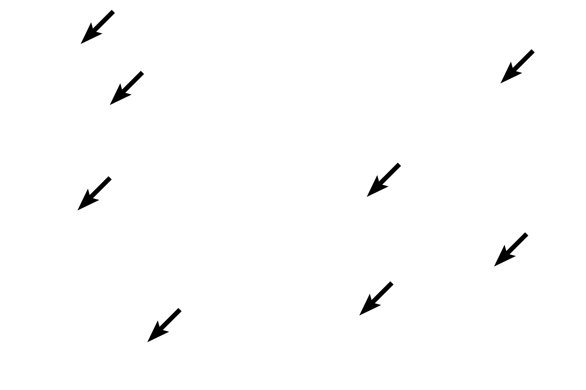 Osteocytes > <p>Woven (immature) bone contains a greater number of osteocytes compared with lamellar (mature) bone and the cells are more rounded in their lacunae. Additionally, the matrix of woven both is less eosinophilic due to the lower content of collagen fibers.   </p>
