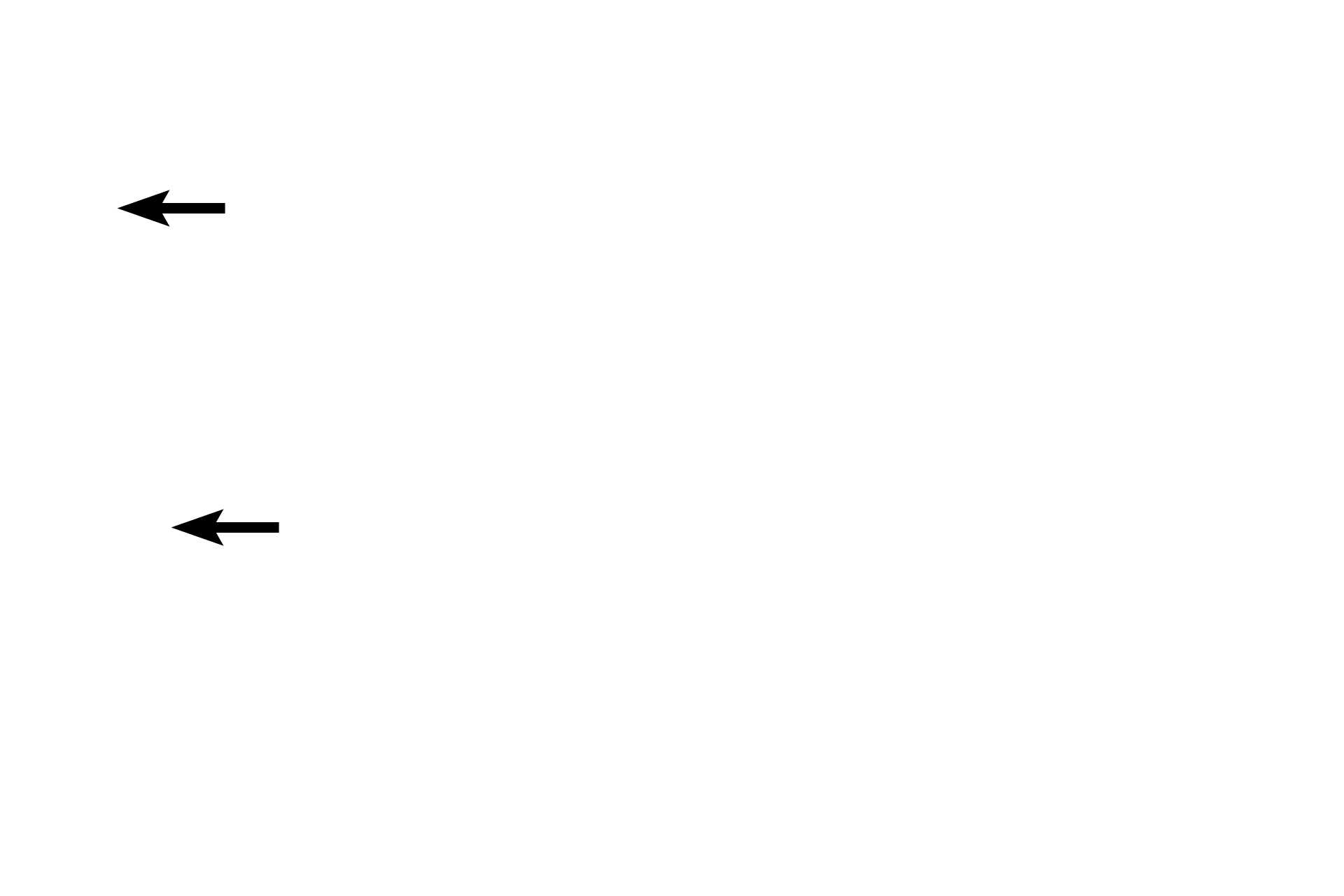 Temporal bone <p>Elastic cartilage, continuous with that of the auricle, supports the auditory meatus in its outer third, while the support of the inner two-thirds is provided by the temporal bone. Typical thin skin, possessing many hairs, sebaceous and ceruminous glands, lines the external auditory meatus. 40x</p>
