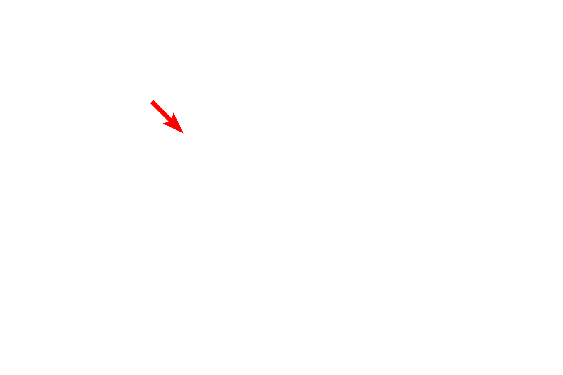 Vestibule > <p>The vestibule is the central space of the osseous labyrinth. Its lateral wall contains the oval window in which the foot plate of the stapes is located. The utricle and saccule, portions of the membranous labyrinth, are suspended in the vestibule but are not illustrated here.</p>
