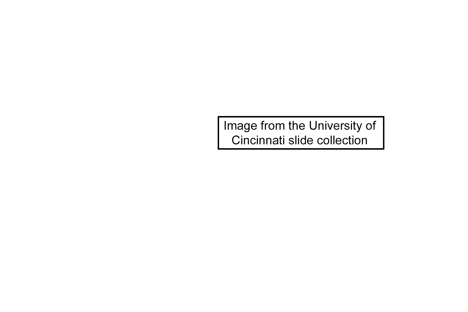 Image credit >  <p>This image was taken of slide in the University of Cincinnati collection.</p>
