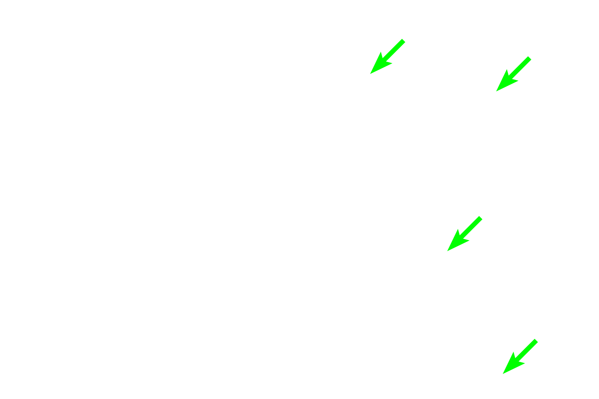 Red bone marrow >  <p>Red marrow fills the spaces between spicules of spongy bone in the epiphyses of adults and is also present in the marrow cavity of younger individuals, as shown here. Red marrow consists of myeloid, (hemopoietic) tissue that produces red and white blood cells.</p>
