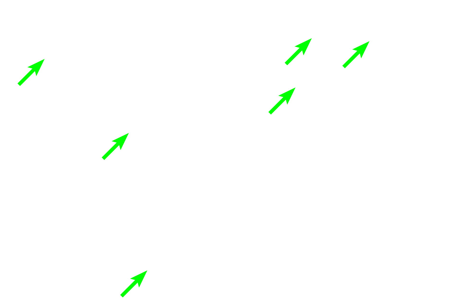 Spongy bone  <p>Grossly, the bone tissue has two different appearances: compact and spongy. Compact (cortical) bone appears as a solid mass to the naked eye. This bone comprises the shafts of long bones and forms a peripheral layer over all bones, except in regions of articular cartilages. Spongy (cancellous) bone is found in the interior and resembles a sponge to the naked eye. It consists of a network of bony spicules or trabeculae, enclosing small marrow spaces. Spongy bone is present in the epiphyses and lining the interior of the diaphysis.  1x, 10x  </p>
