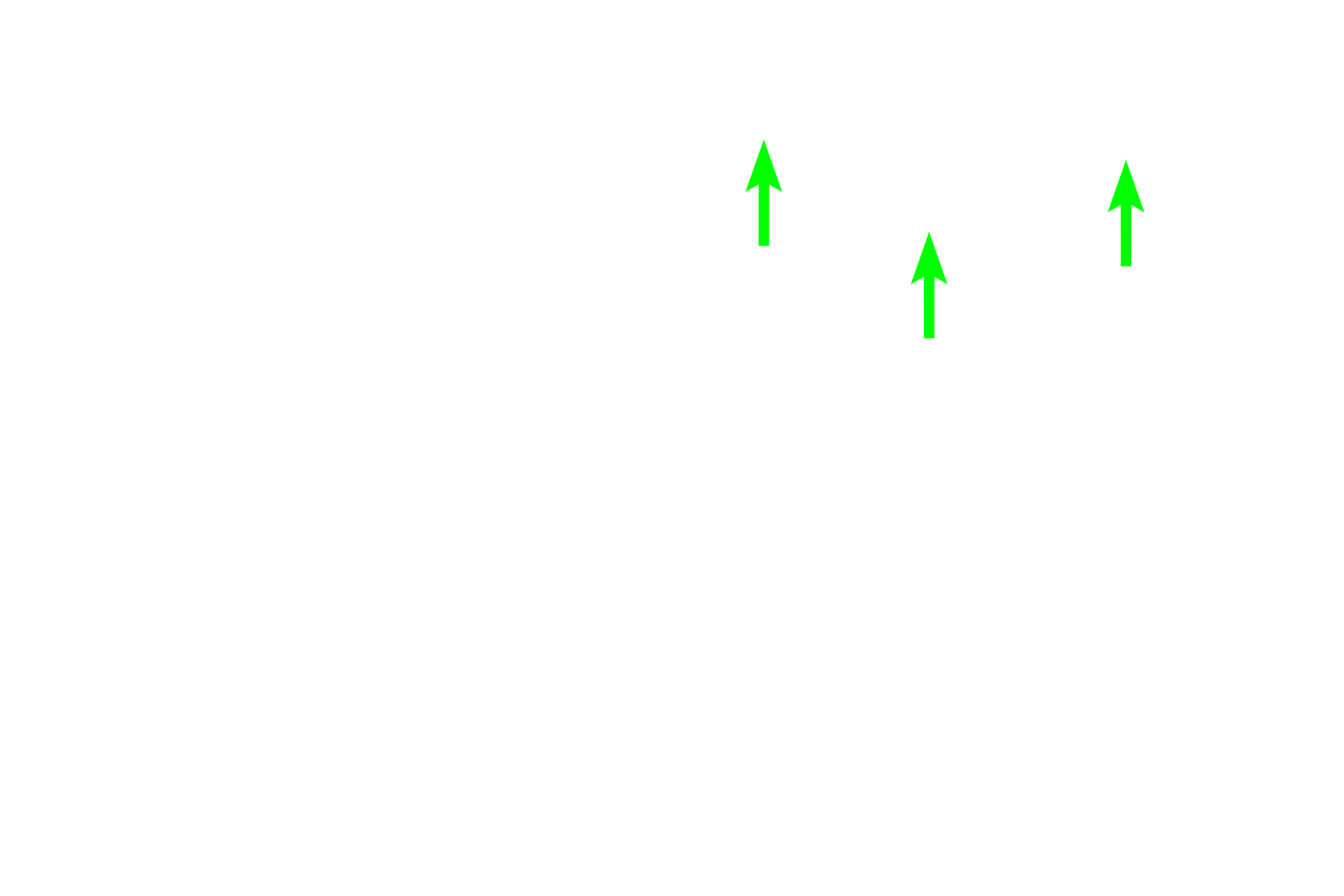 Marrow spaces <p>Spongy bone is seen in a dried preparation (left and above right) and in a histological preparation of decalcified bone (below right). Spongy (cancellous) bone, located in the interior of bones, is present in the epiphyses and metaphyses as well as forming a thin lining around the interior of compact bone in the diaphysis. To the naked eye, spongy bone looks like a sponge, consisting of a network of bony spicules or trabeculae, enclosing small spaces containing red marrow. 1x (left), 10x (top right), 100x (bottom right).</p>
