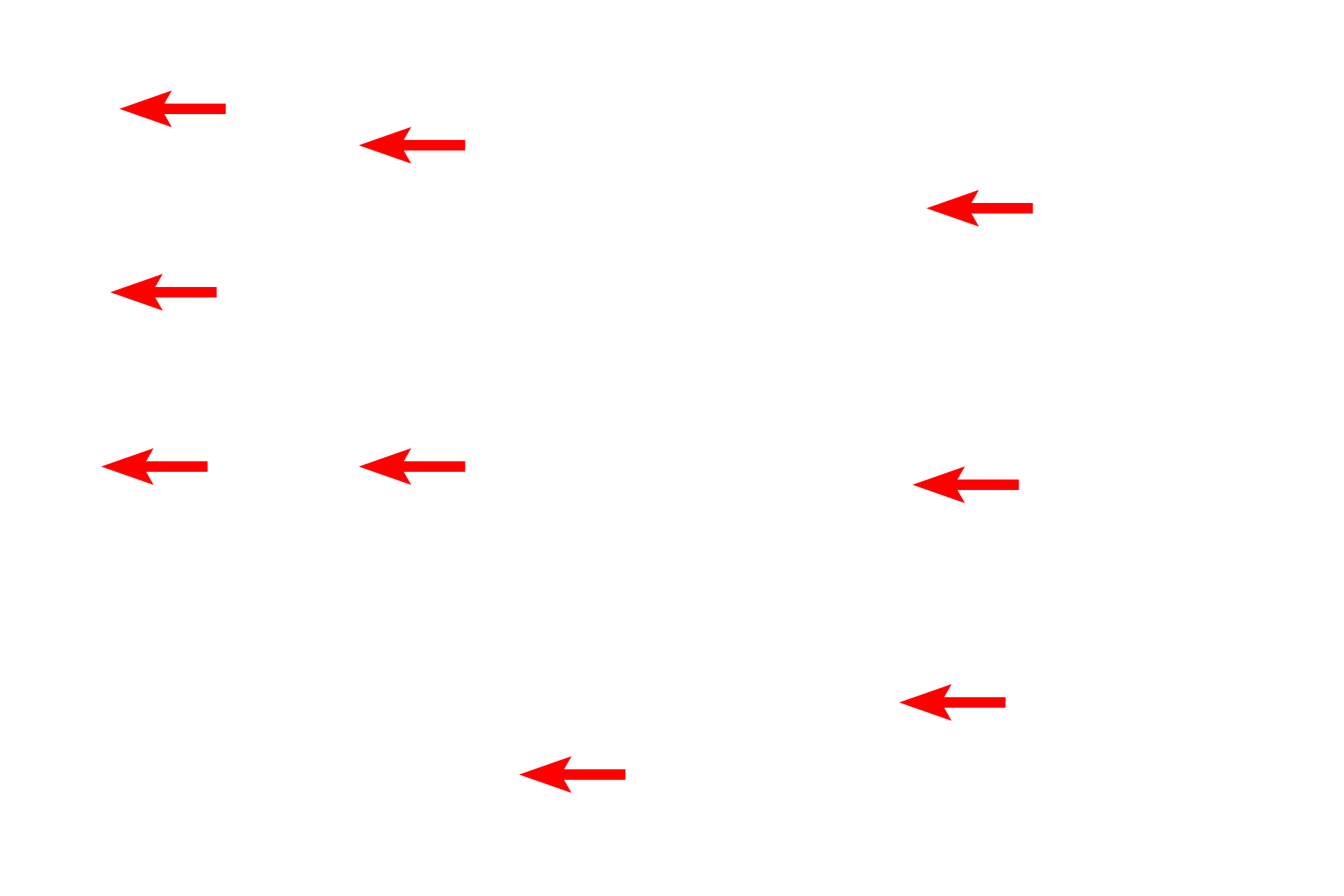  - Haversian canals <p>This longitudinal view of compact, lamellar bone shows numerous, vertically-oriented Haversian canals and their interconnecting Volkmann’s canals. Haversian systems are oriented parallel to the long axis of the diaphysis; Volkmann’s canals are oriented mostly in a transverse plane.  Ground, compact bone, 200x</p>
