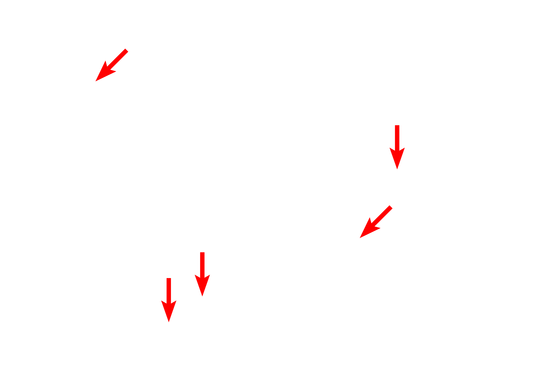 Volkmann's canals <p>This longitudinal view of compact, lamellar bone shows numerous, vertically-oriented Haversian canals and their interconnecting Volkmann’s canals. Haversian systems are oriented parallel to the long axis of the diaphysis; Volkmann’s canals are oriented mostly in a transverse plane.  Ground, compact bone, 200x</p>
